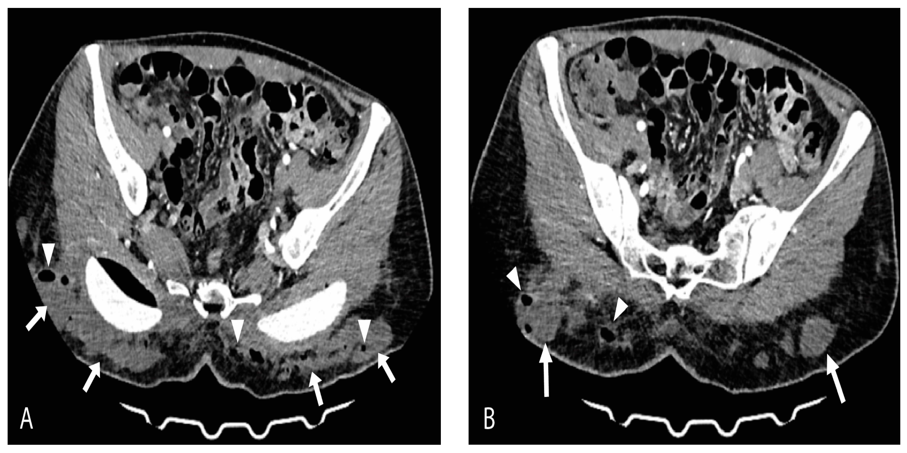 Medicina 59 00914 g001 Medicina 59 00914 g001