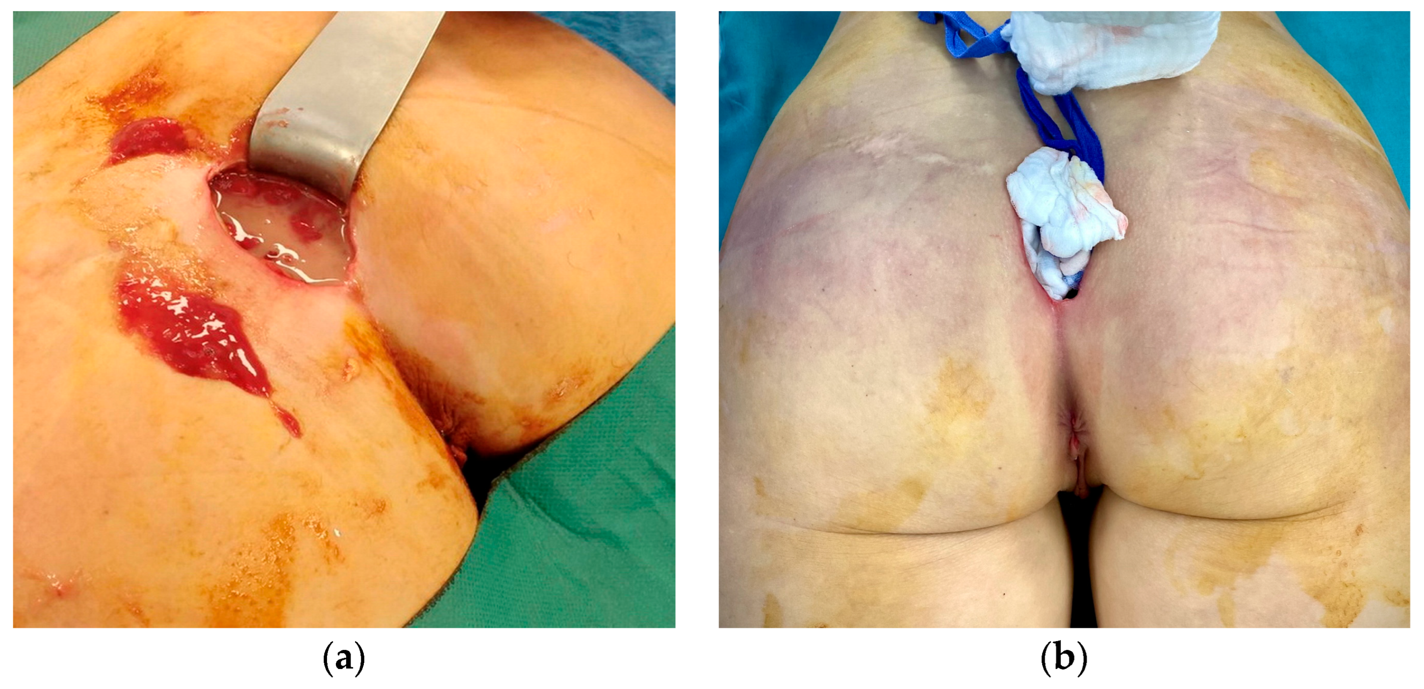 Medicina 59 00914 g002 Medicina 59 00914 g002