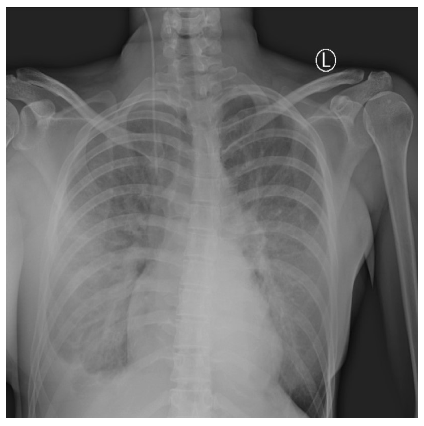 Medicina 59 00914 g004 Medicina 59 00914 g004