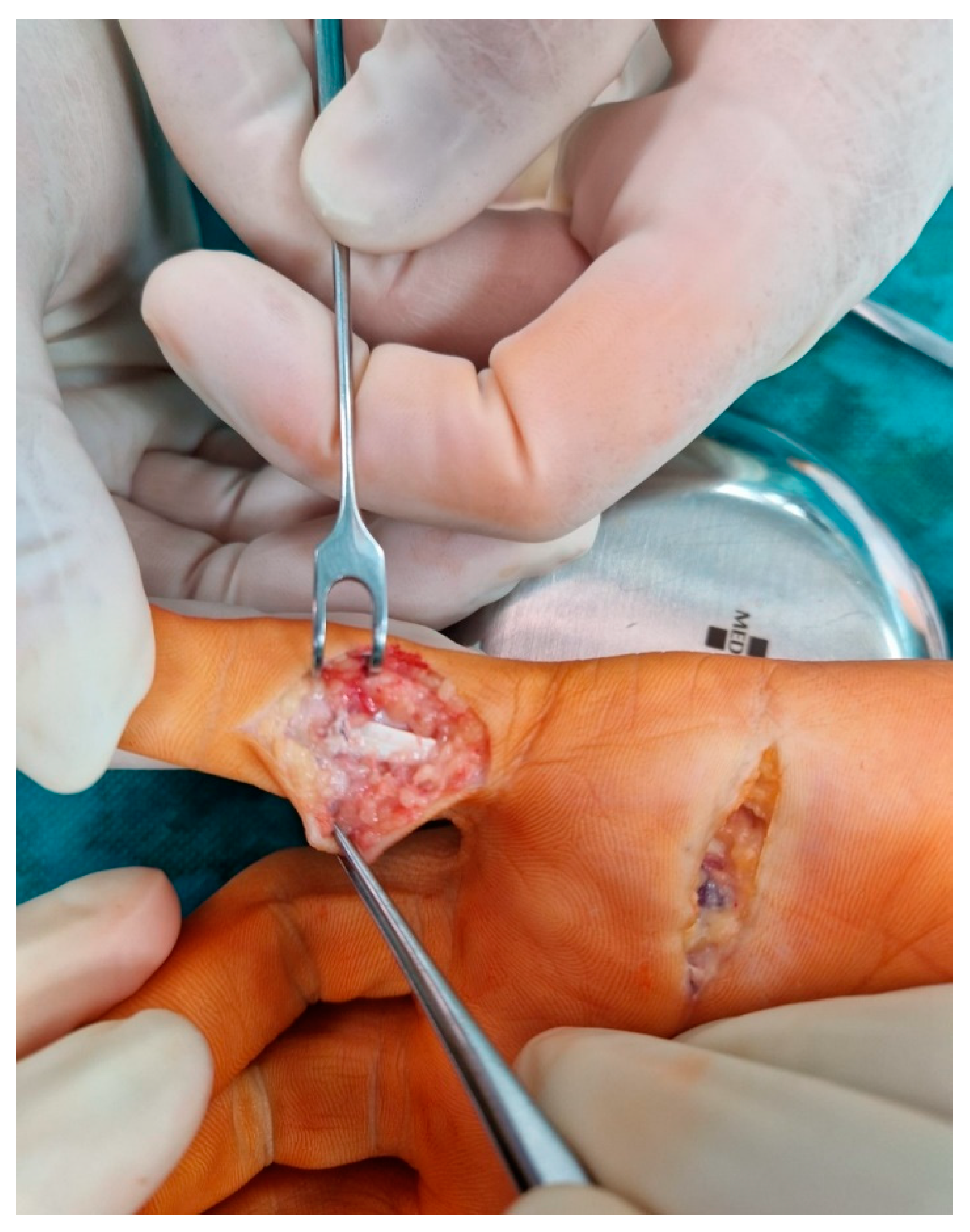 Medicina 59 00966 g003