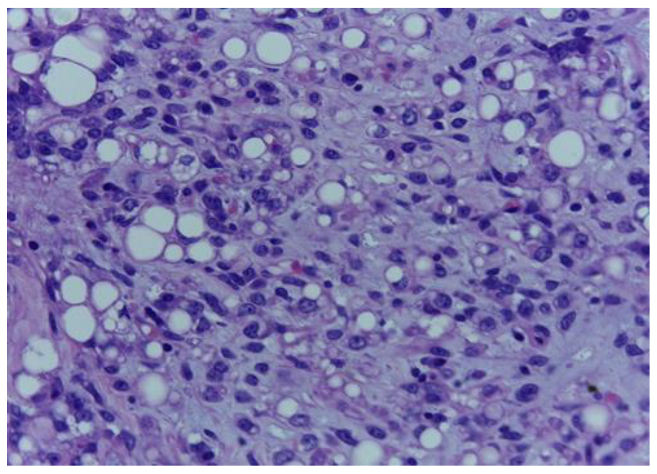 Medicina 59 00967 g002 Medicina 59 00967 g002