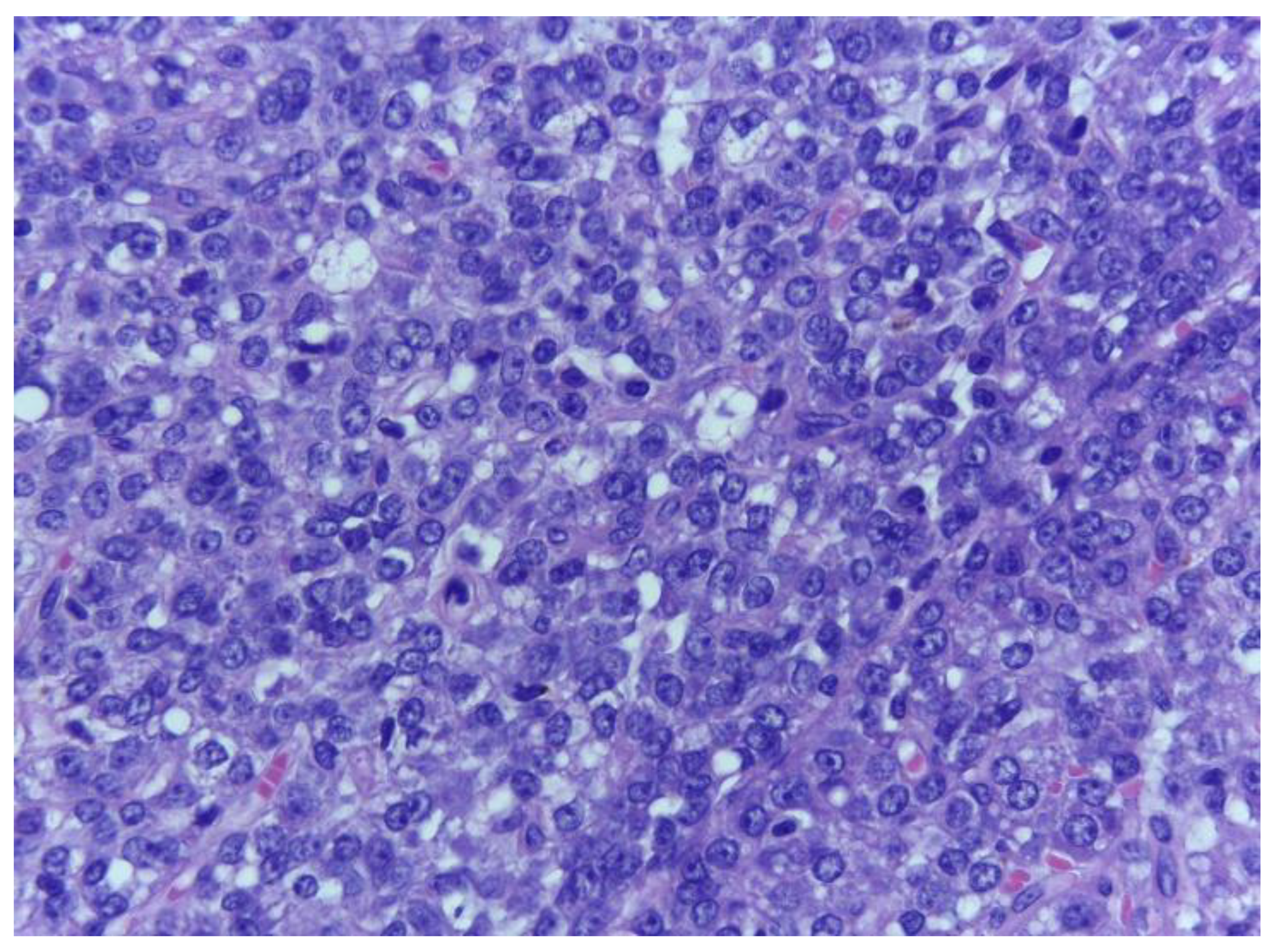 Medicina 59 00967 g006 Medicina 59 00967 g006