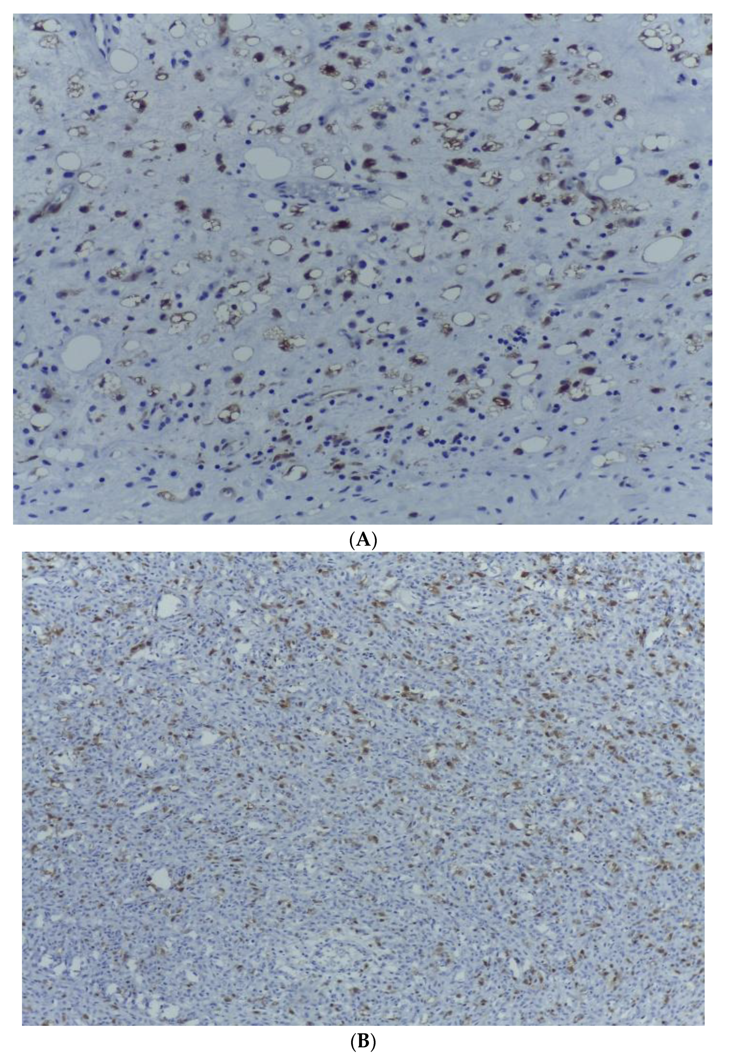 Medicina 59 00967 g008 Medicina 59 00967 g008