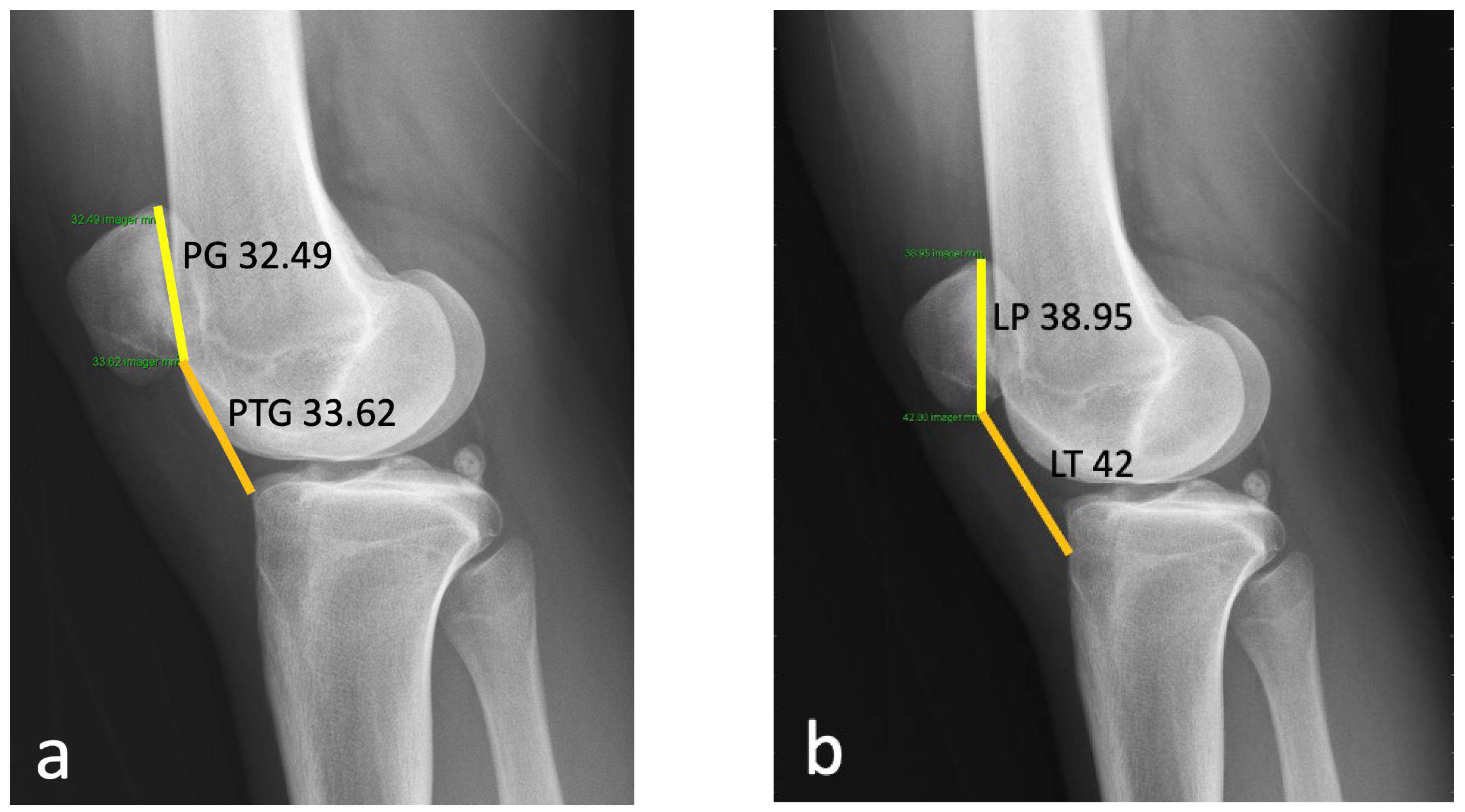 Medicina 59 00986 g004