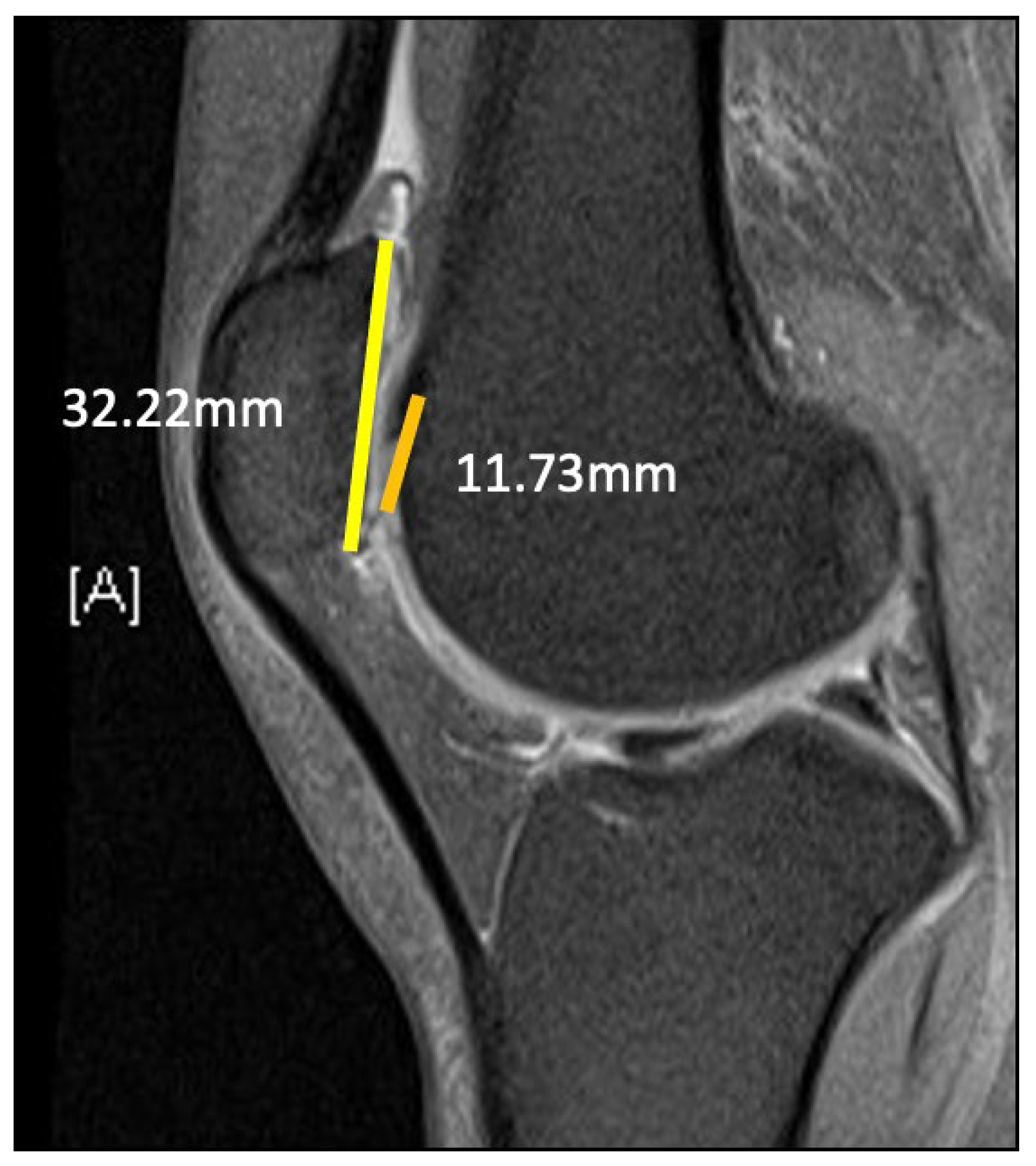 Medicina 59 00986 g005