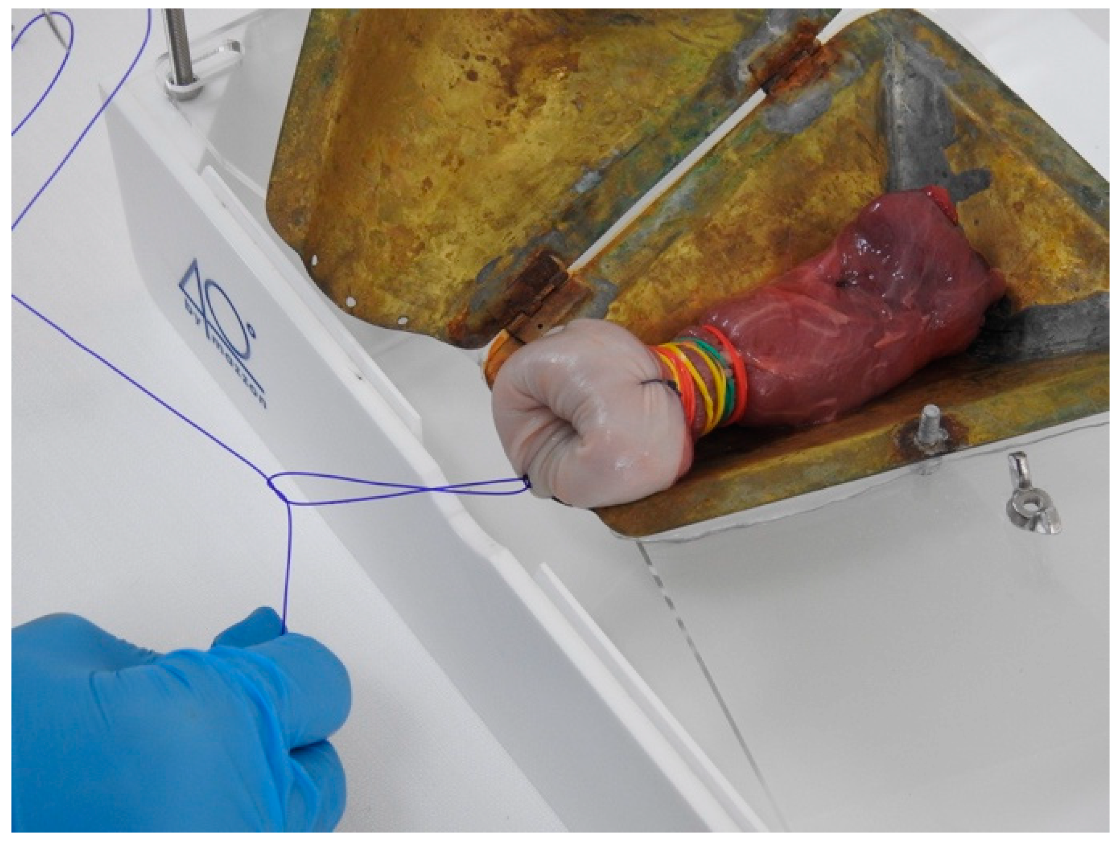 Medicina 59 01019 g005 Medicina 59 01019 g005