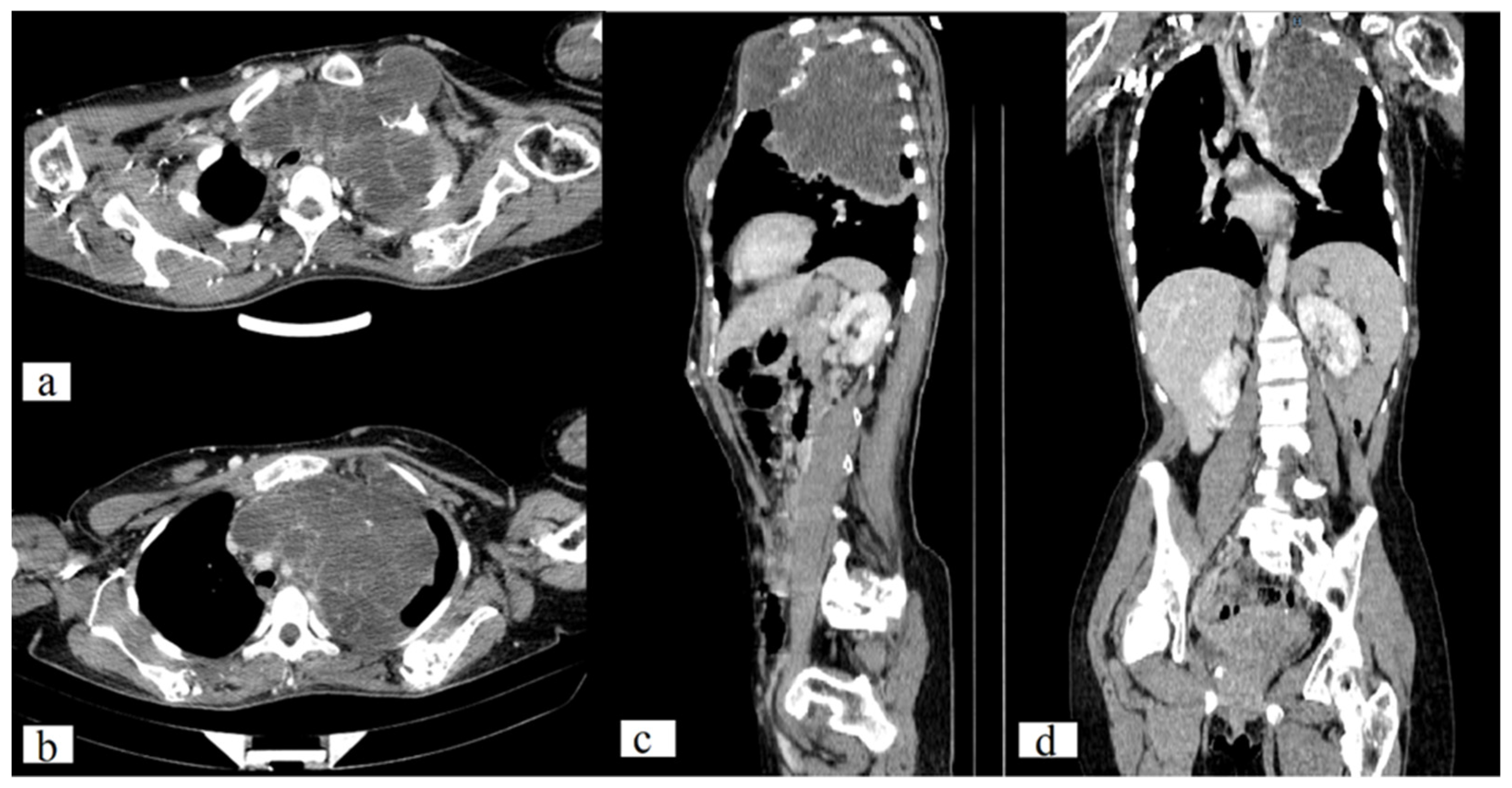 Medicina 59 01056 g003