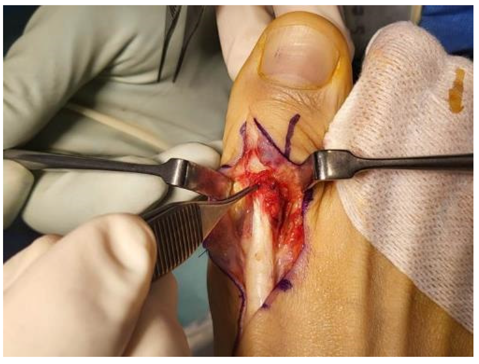 Medicina 59 01069 g004