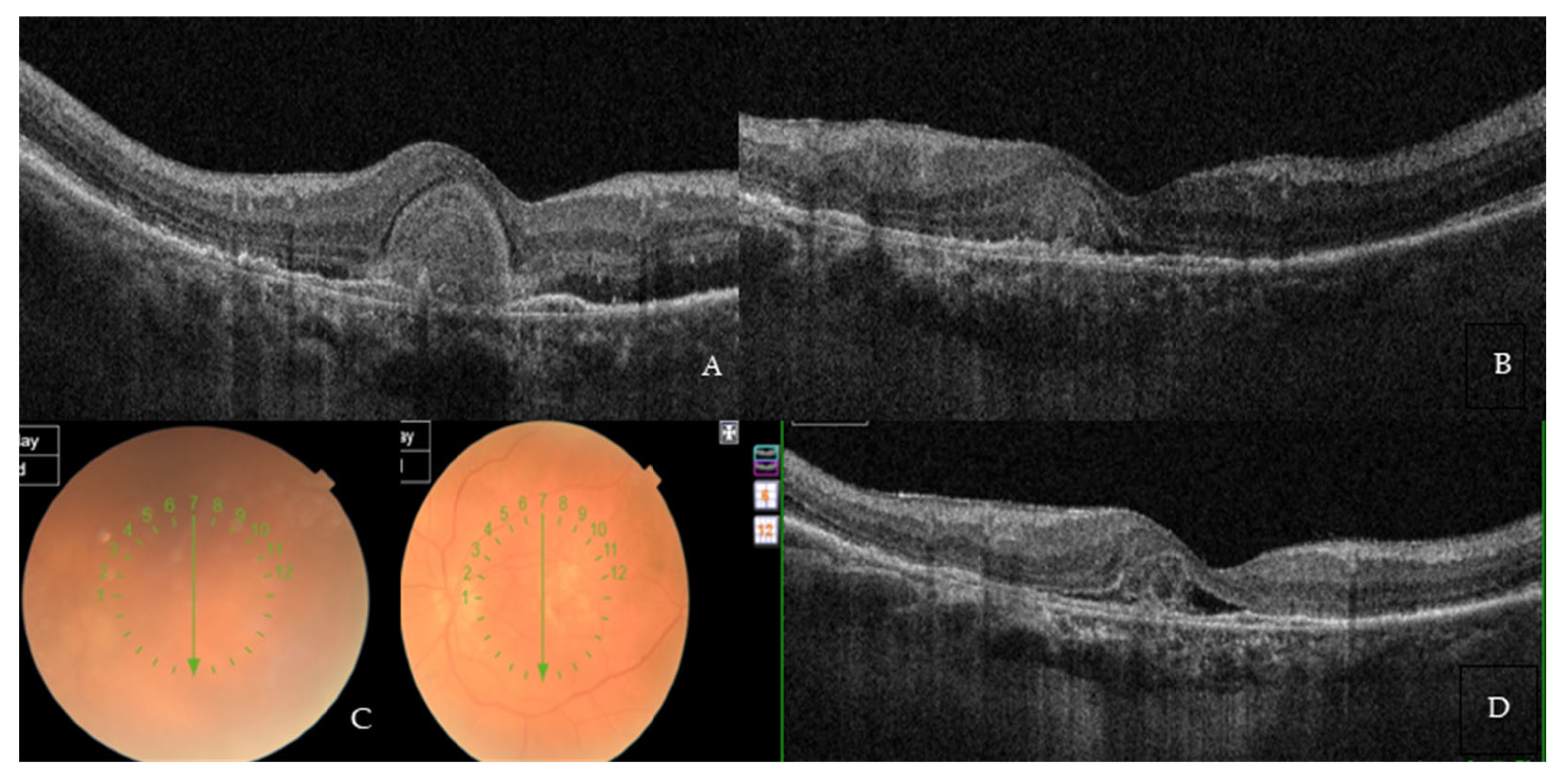 Medicina 59 01110 g004
