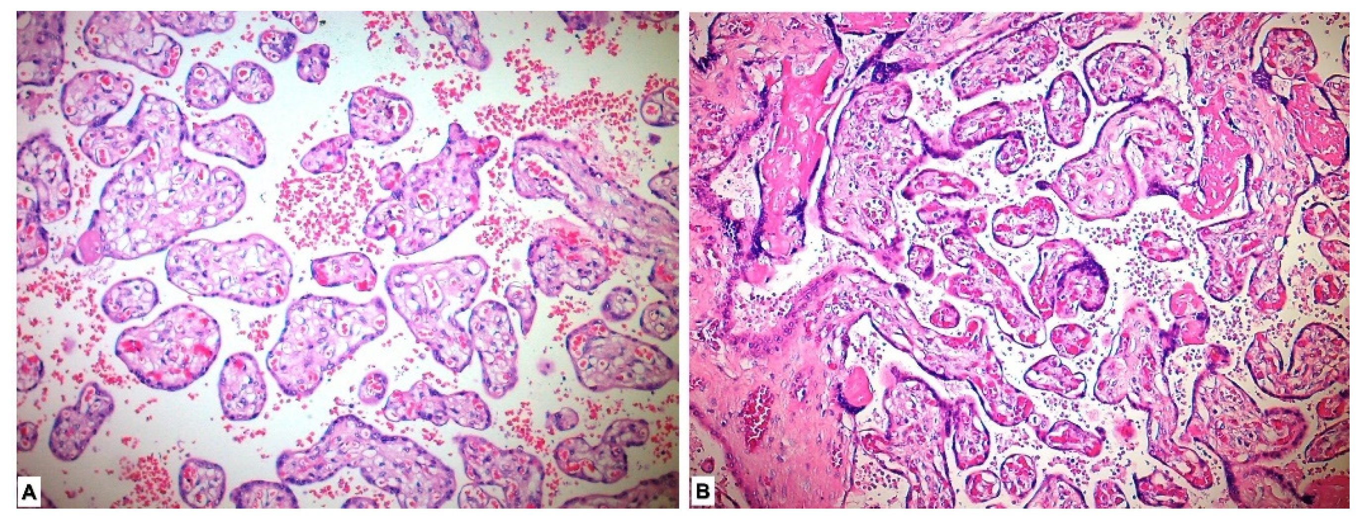 Medicina 59 01145 g001 Medicina 59 01145 g001