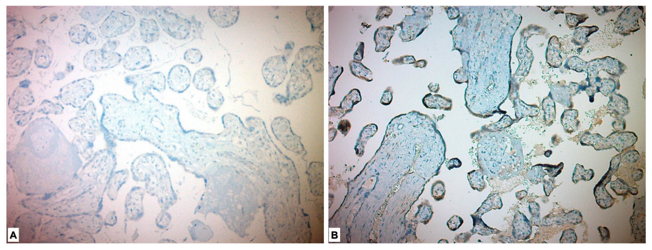 Medicina 59 01145 g002 Medicina 59 01145 g002