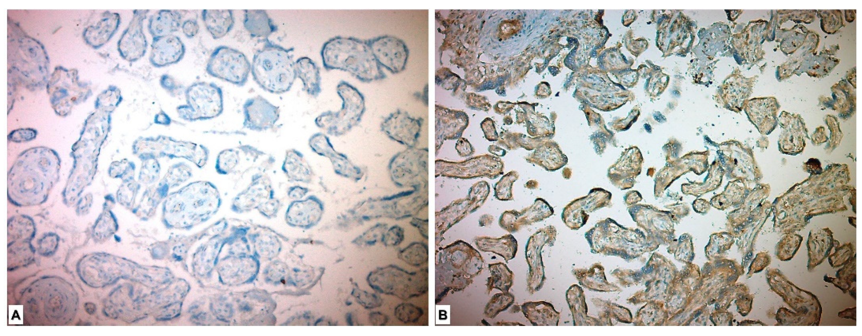 Medicina 59 01145 g003 Medicina 59 01145 g003