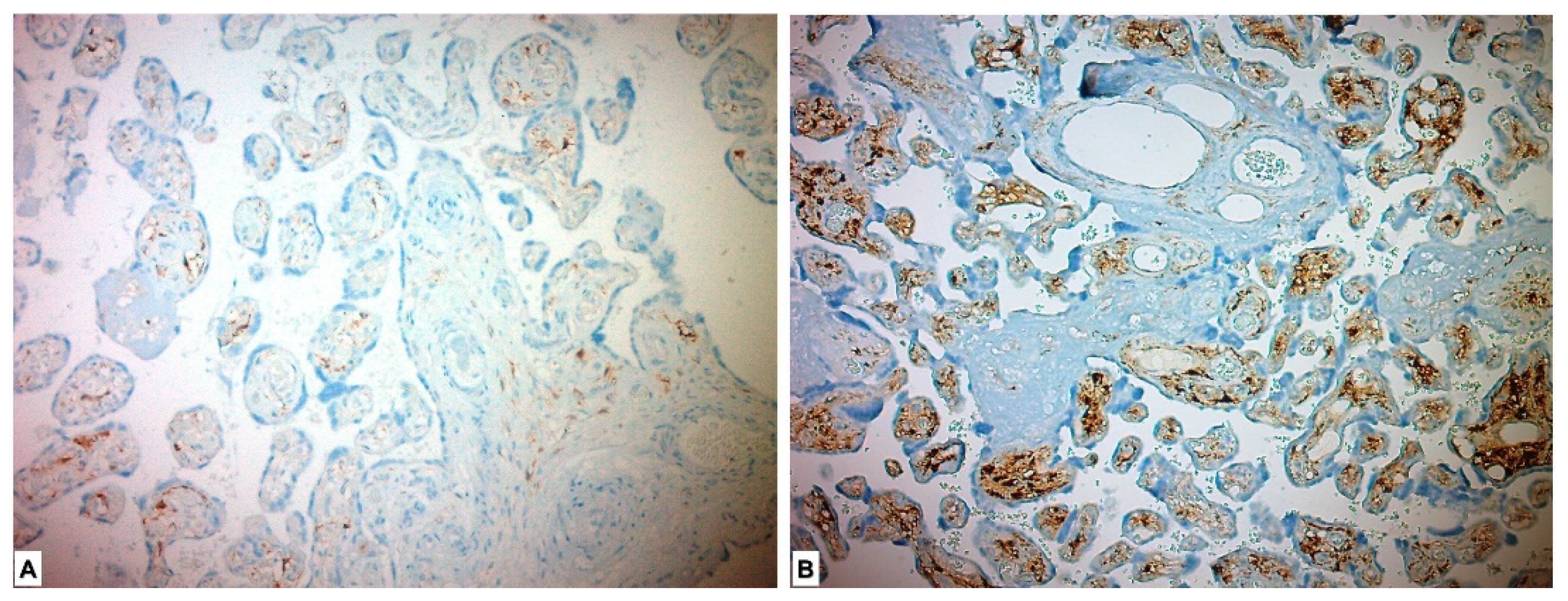 Medicina 59 01145 g004 Medicina 59 01145 g004