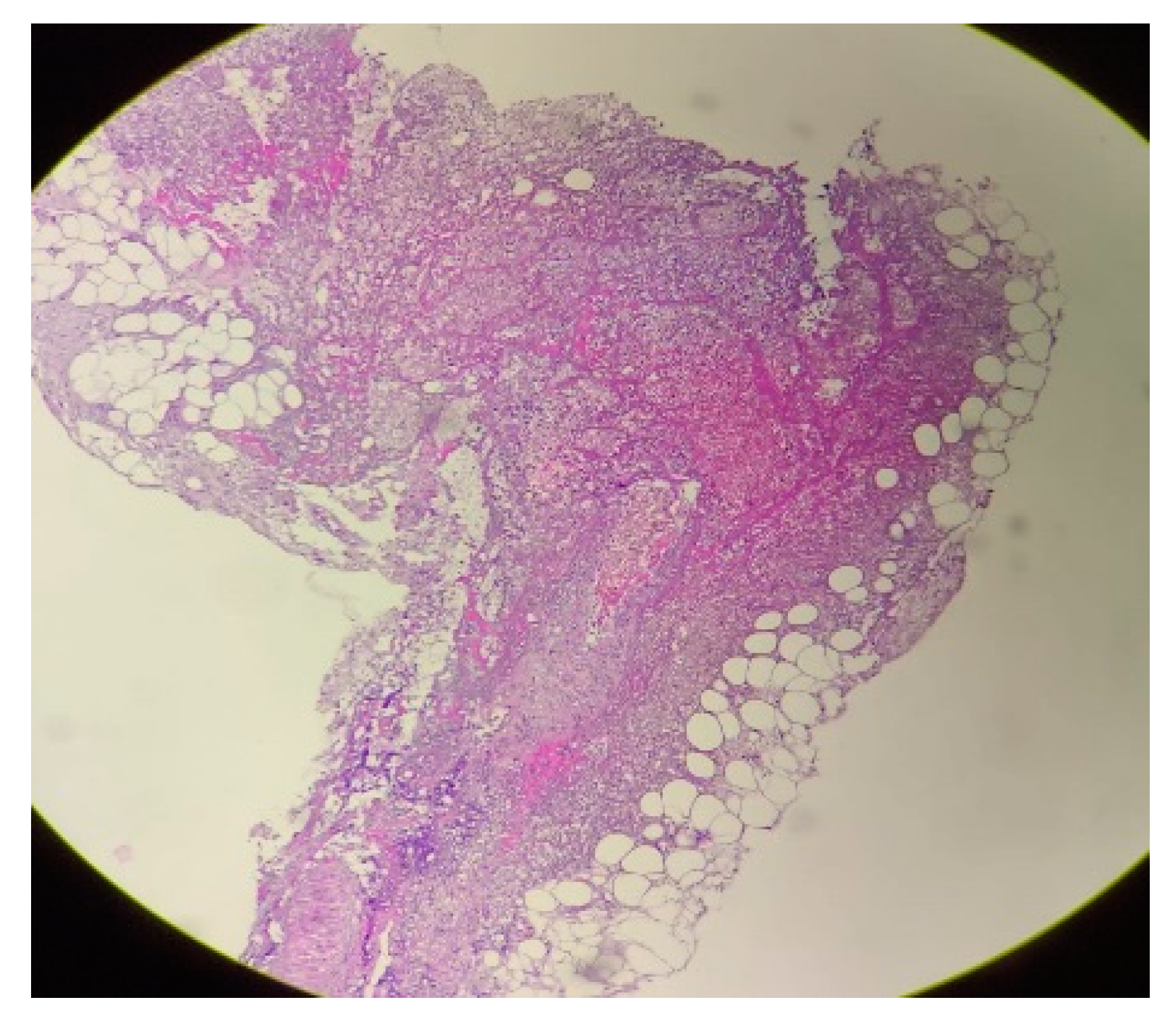 Medicina 59 01162 g003 Medicina 59 01162 g003