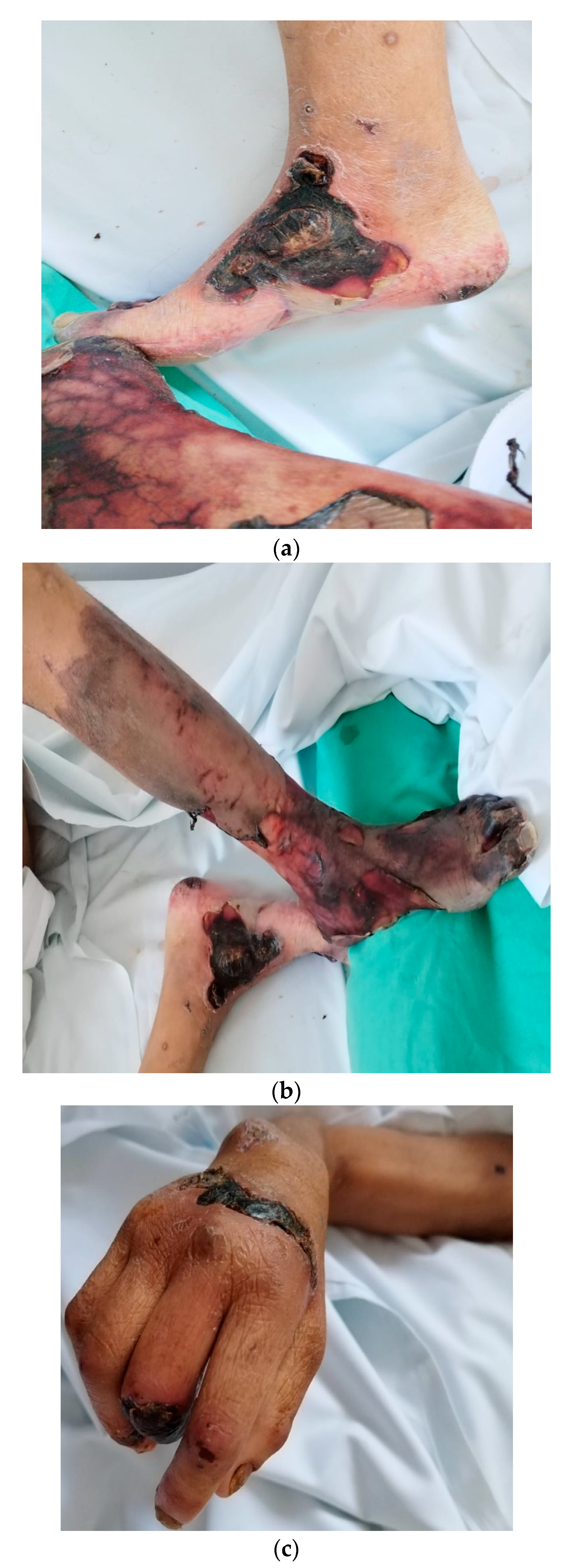 Medicina 59 01162 g005a Medicina 59 01162 g005a