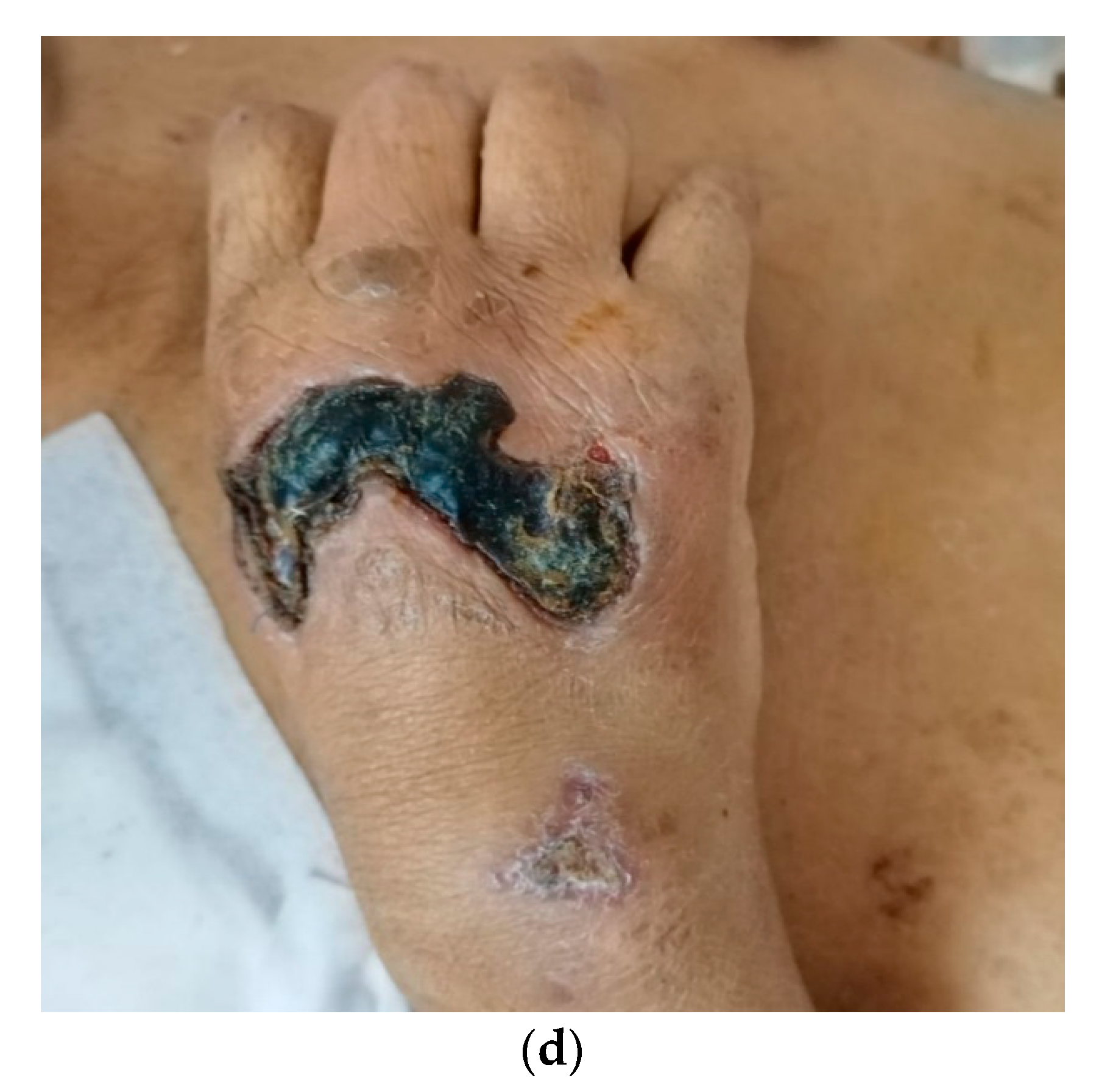 Medicina 59 01162 g005b Medicina 59 01162 g005b