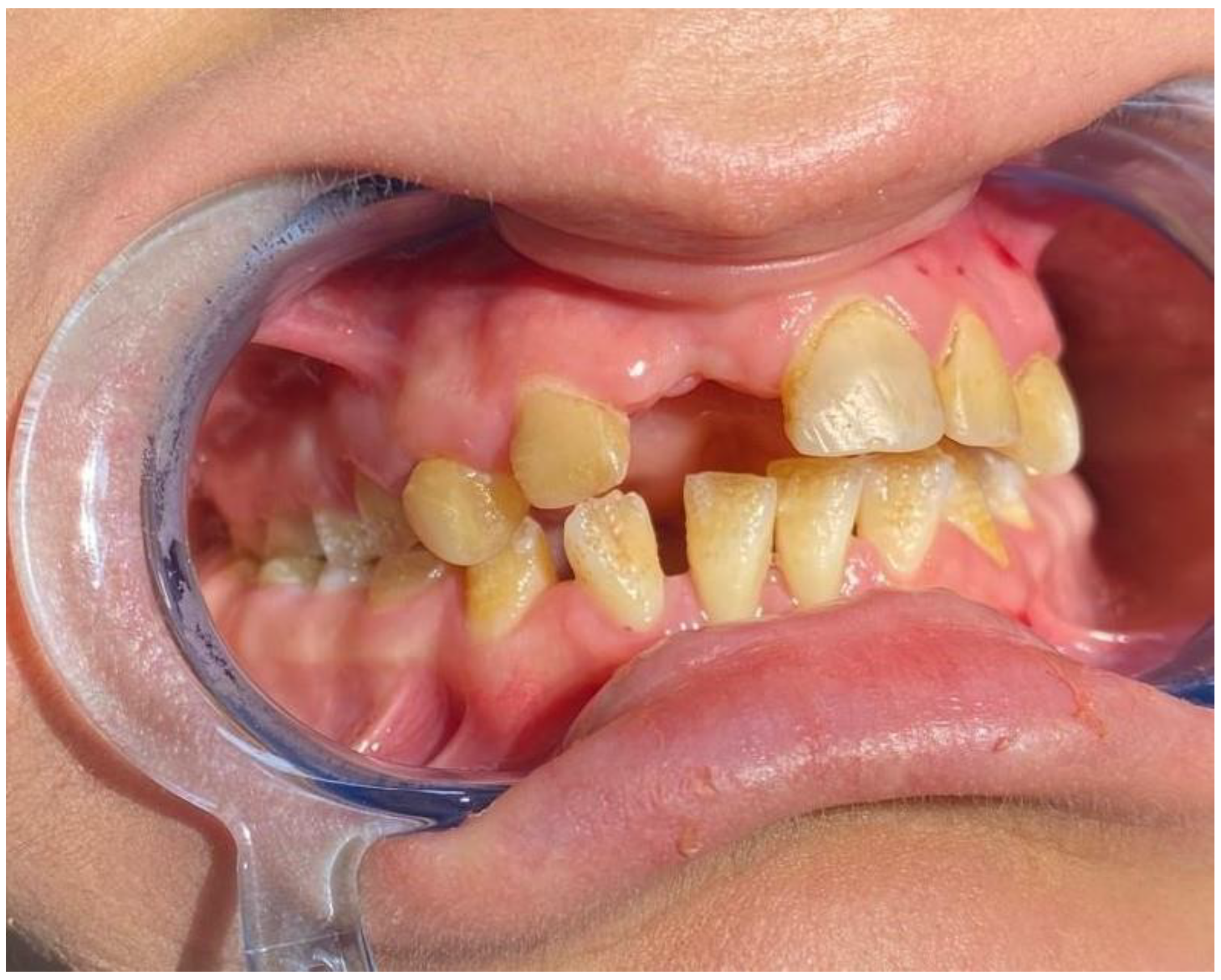 Medicina 59 01185 g002 Medicina 59 01185 g002