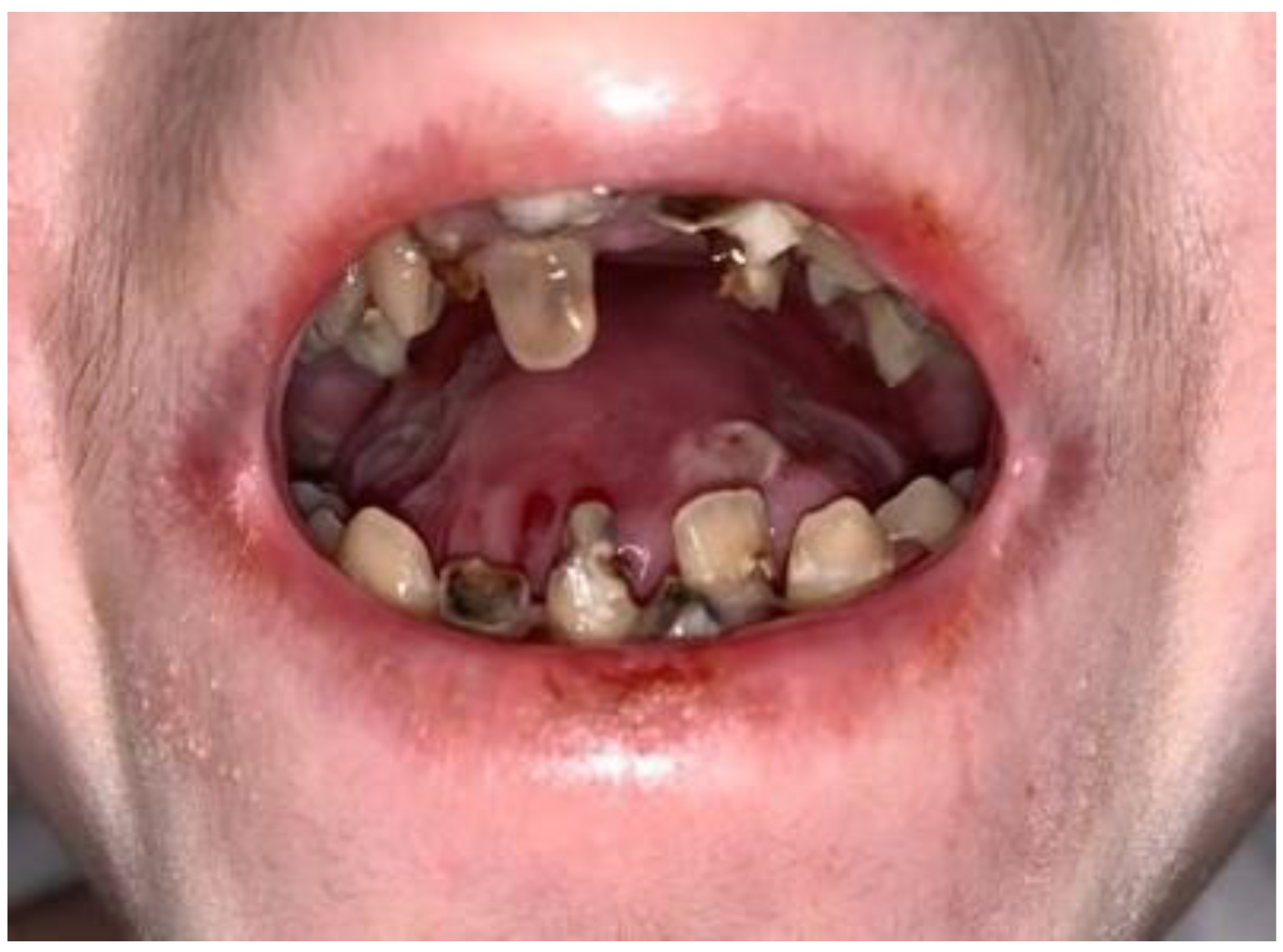 Medicina 59 01185 g003 Medicina 59 01185 g003