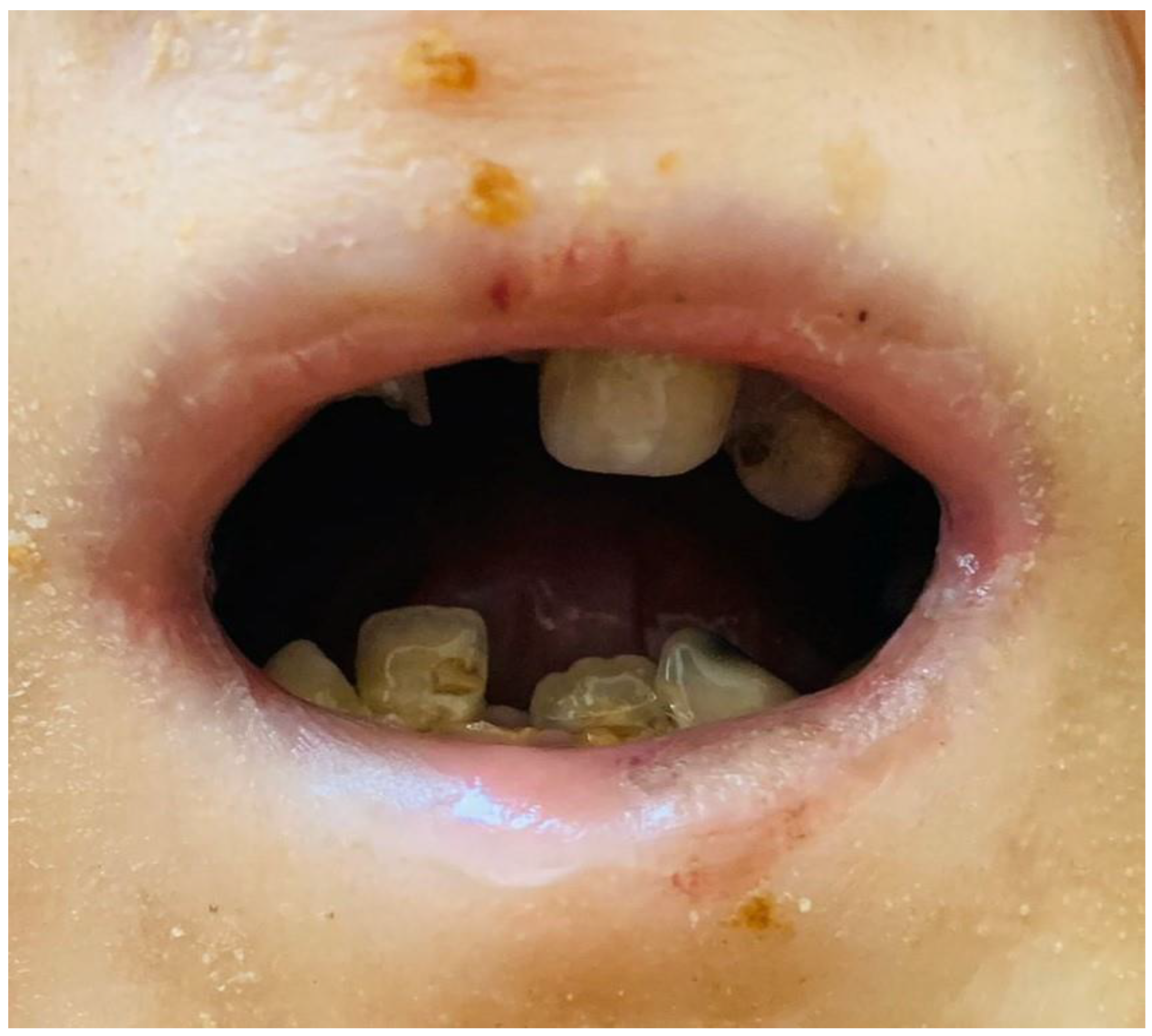 Medicina 59 01185 g004 Medicina 59 01185 g004