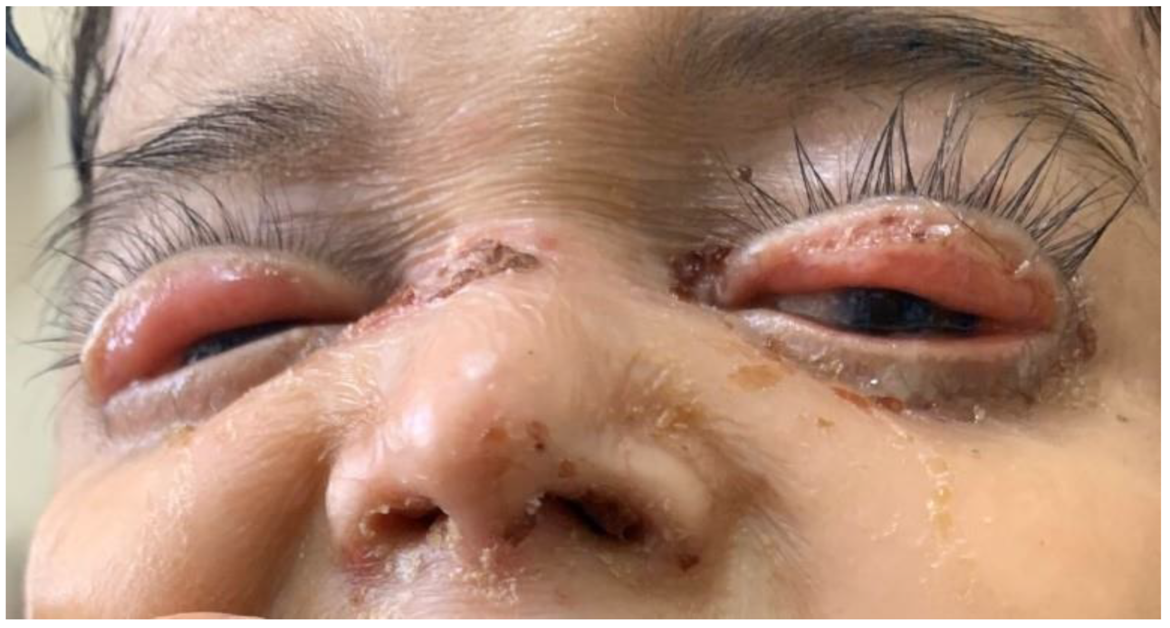 Medicina 59 01185 g005 Medicina 59 01185 g005