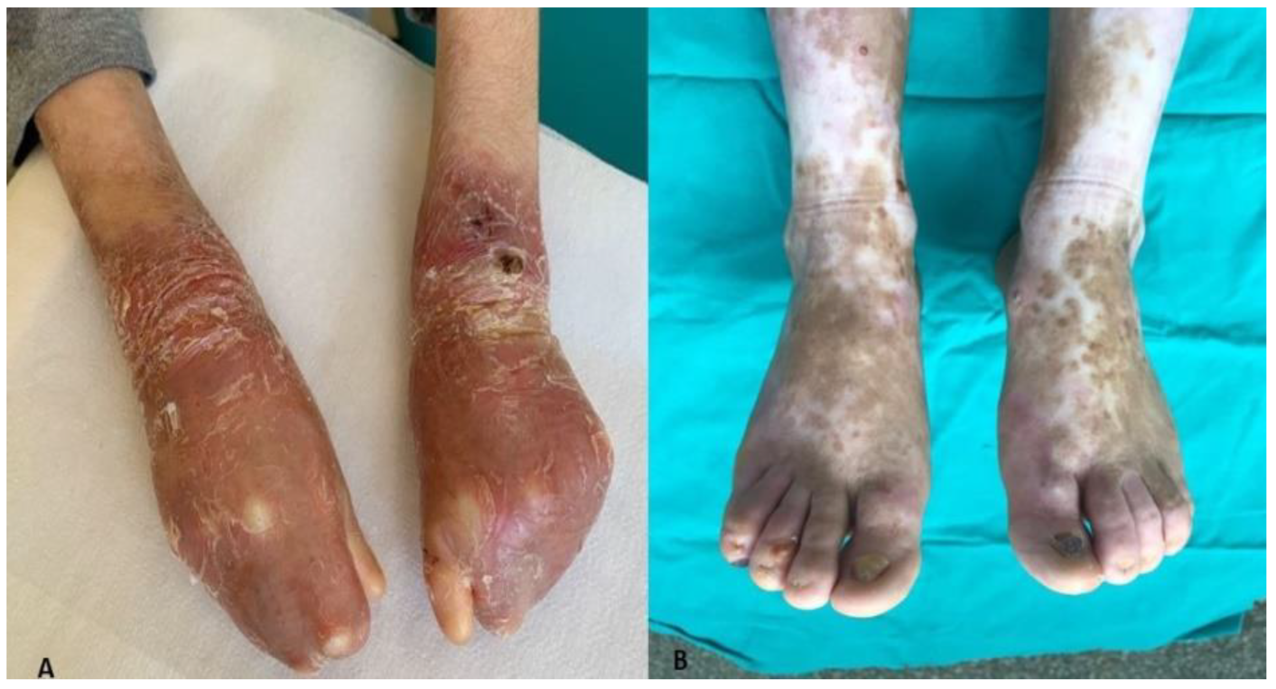 Medicina 59 01185 g006 Medicina 59 01185 g006