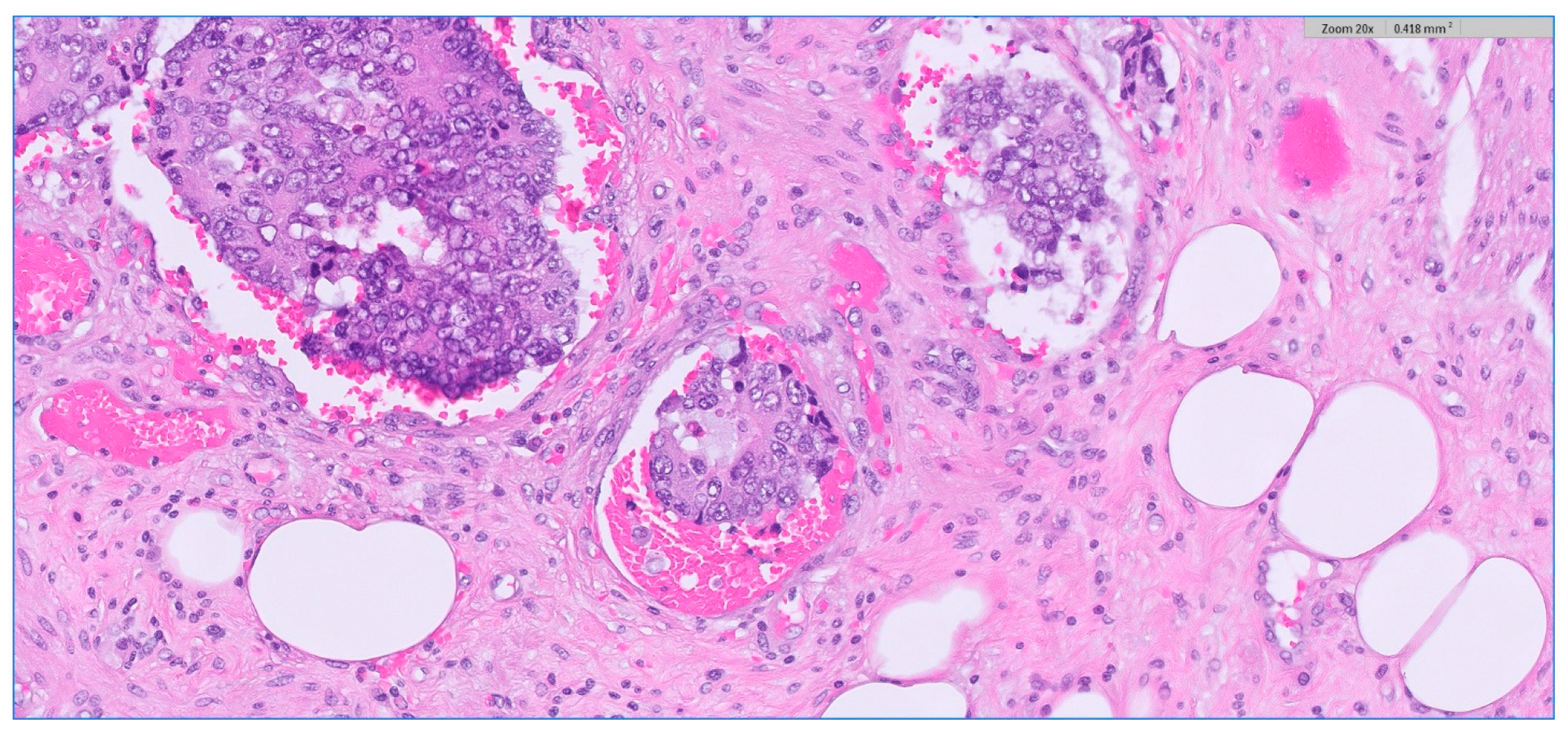 Medicina 59 01224 g007 Medicina 59 01224 g007