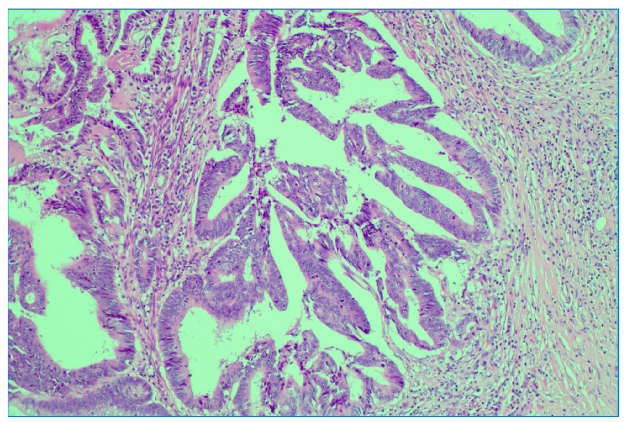 Medicina 59 01224 g010 Medicina 59 01224 g010