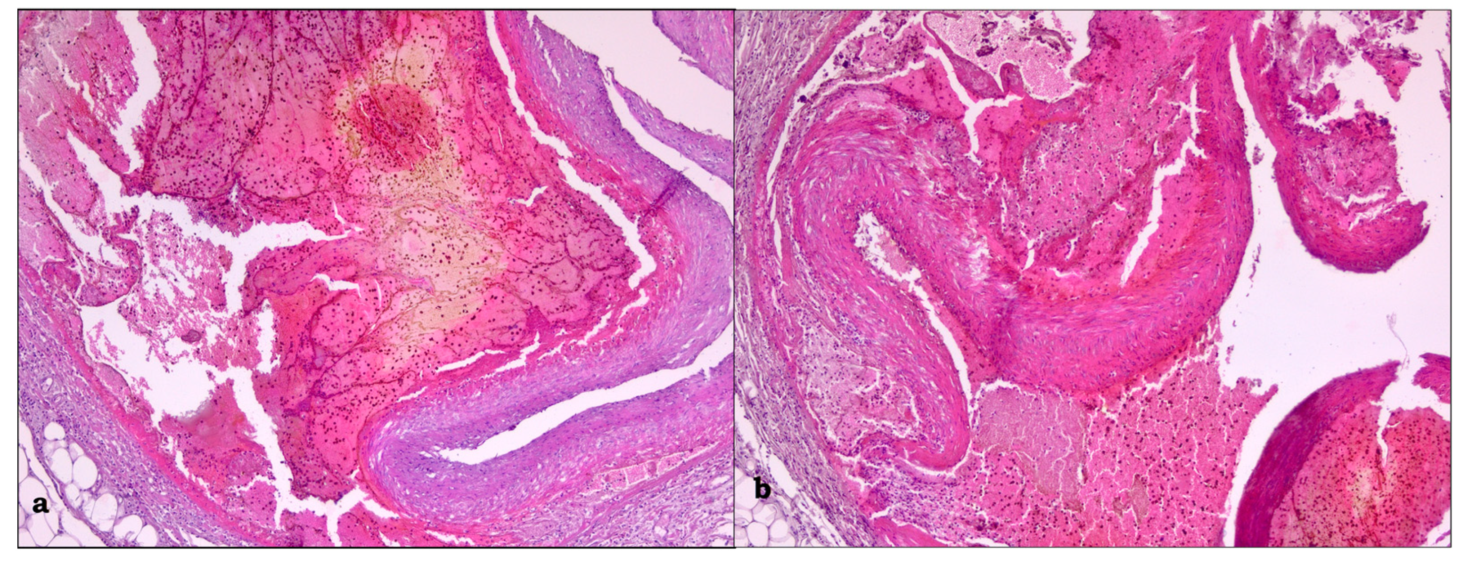 Medicina 59 01257 g005