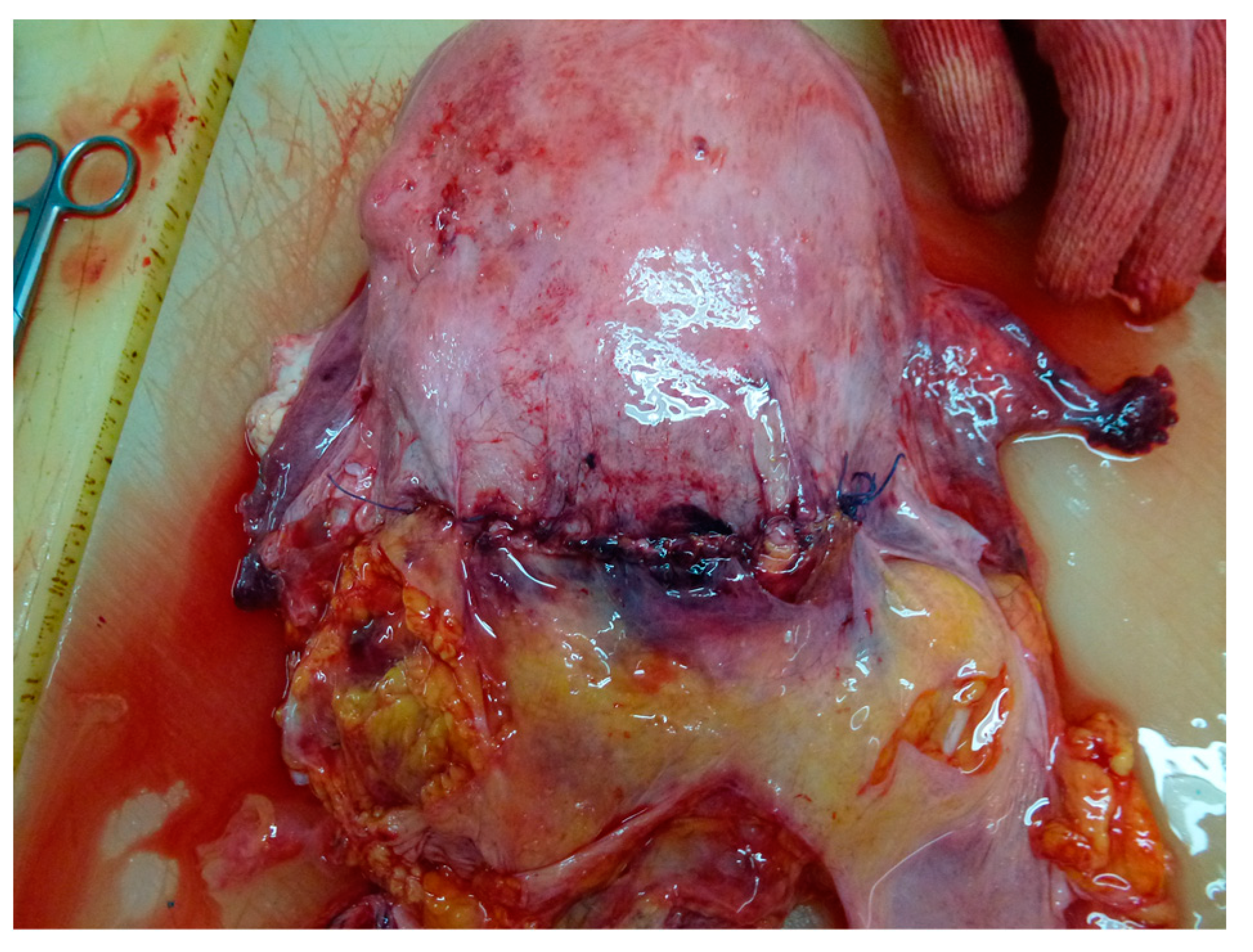 Medicina 59 01257 g006