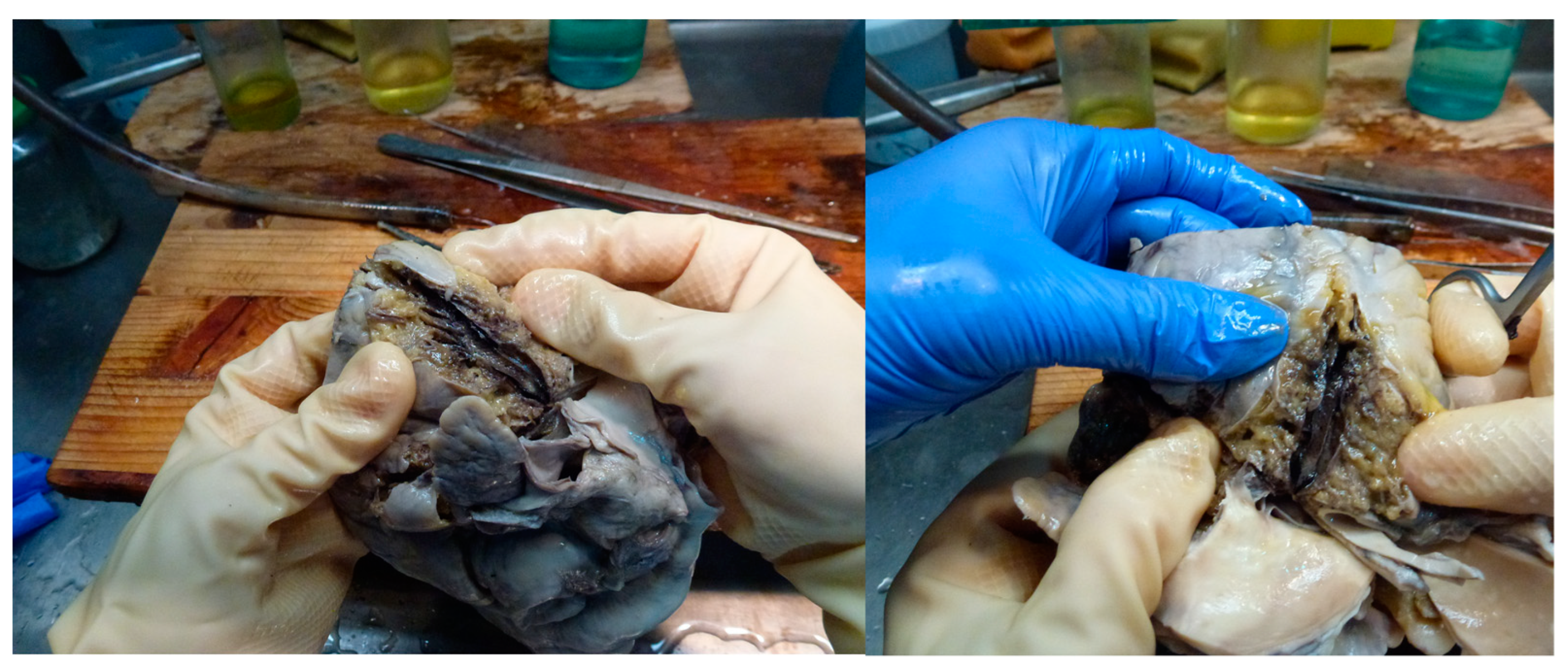 Medicina 59 01257 g008