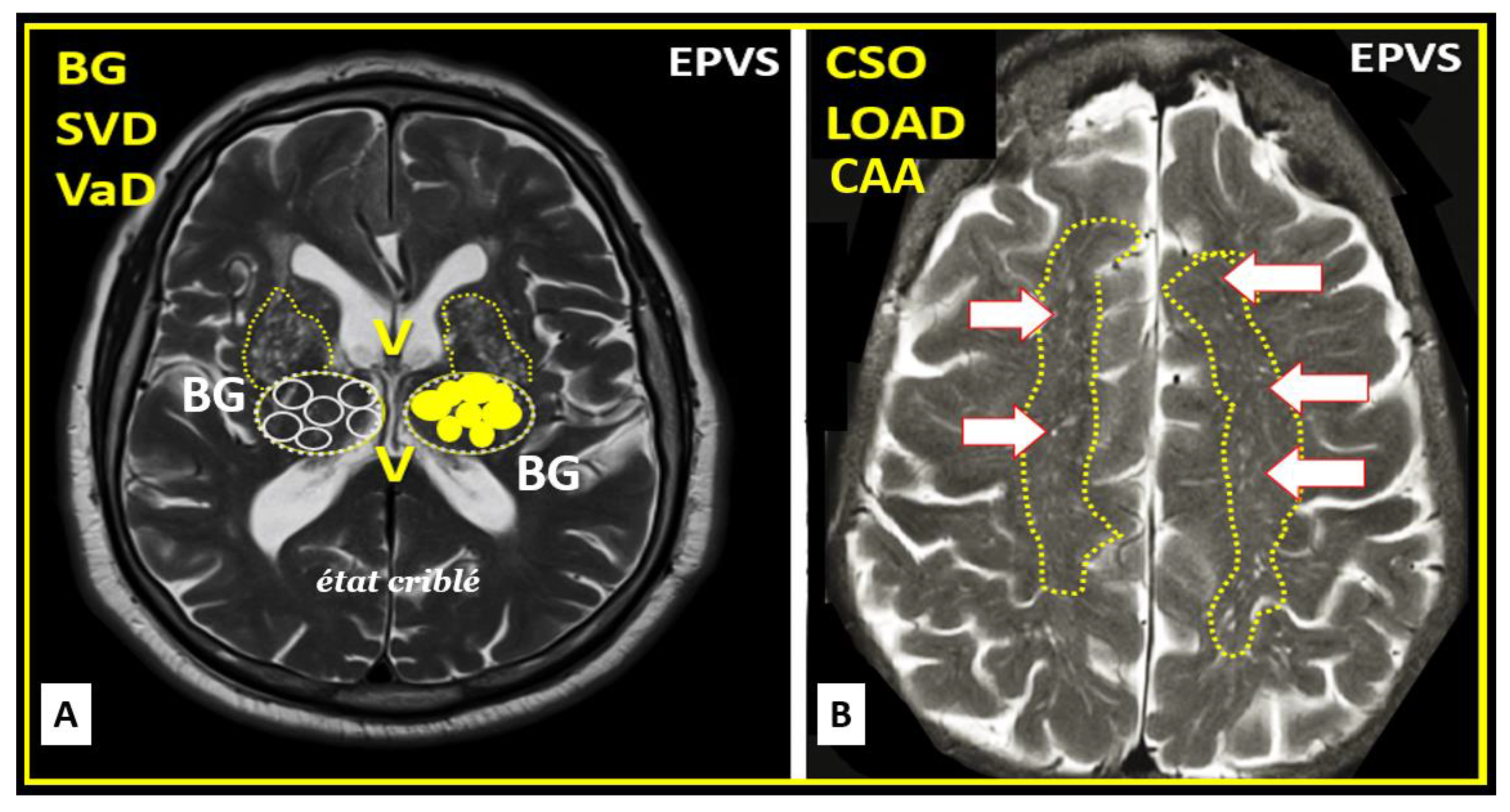 Medicina 59 01337 g014 Medicina 59 01337 g014