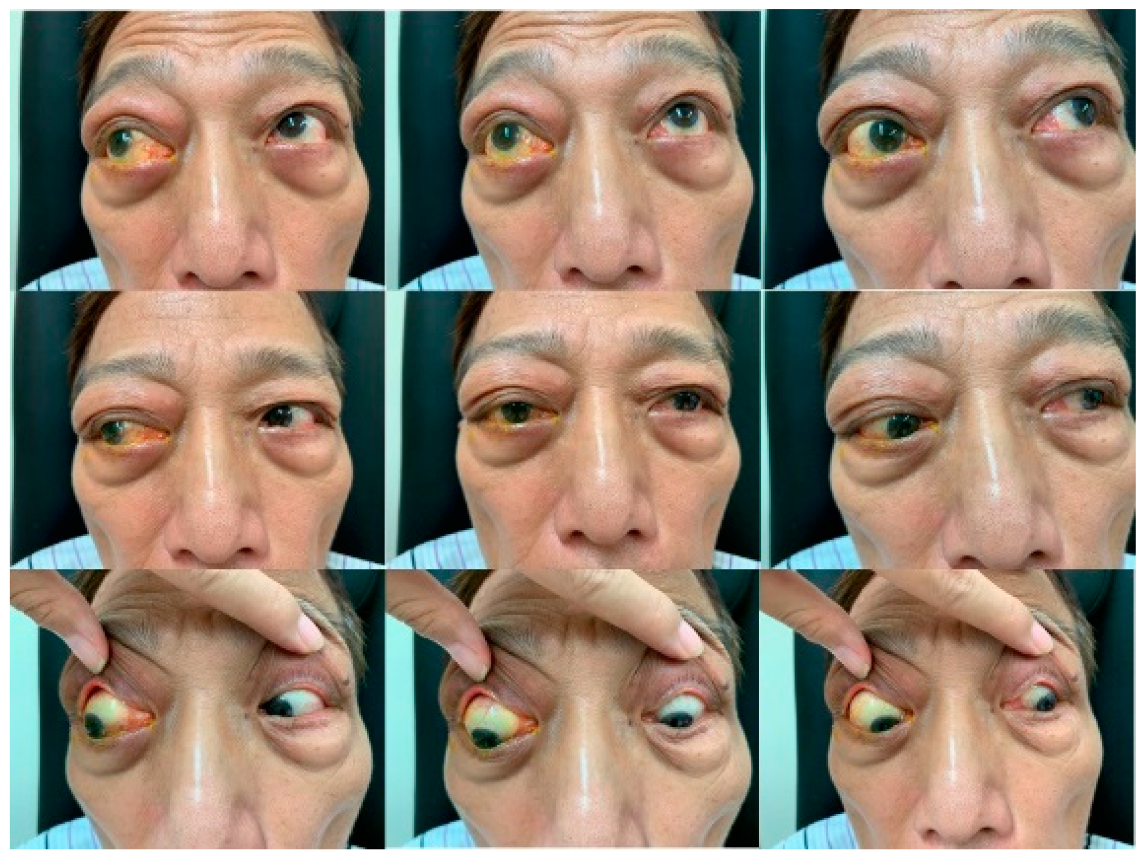 Medicina 59 01381 g001