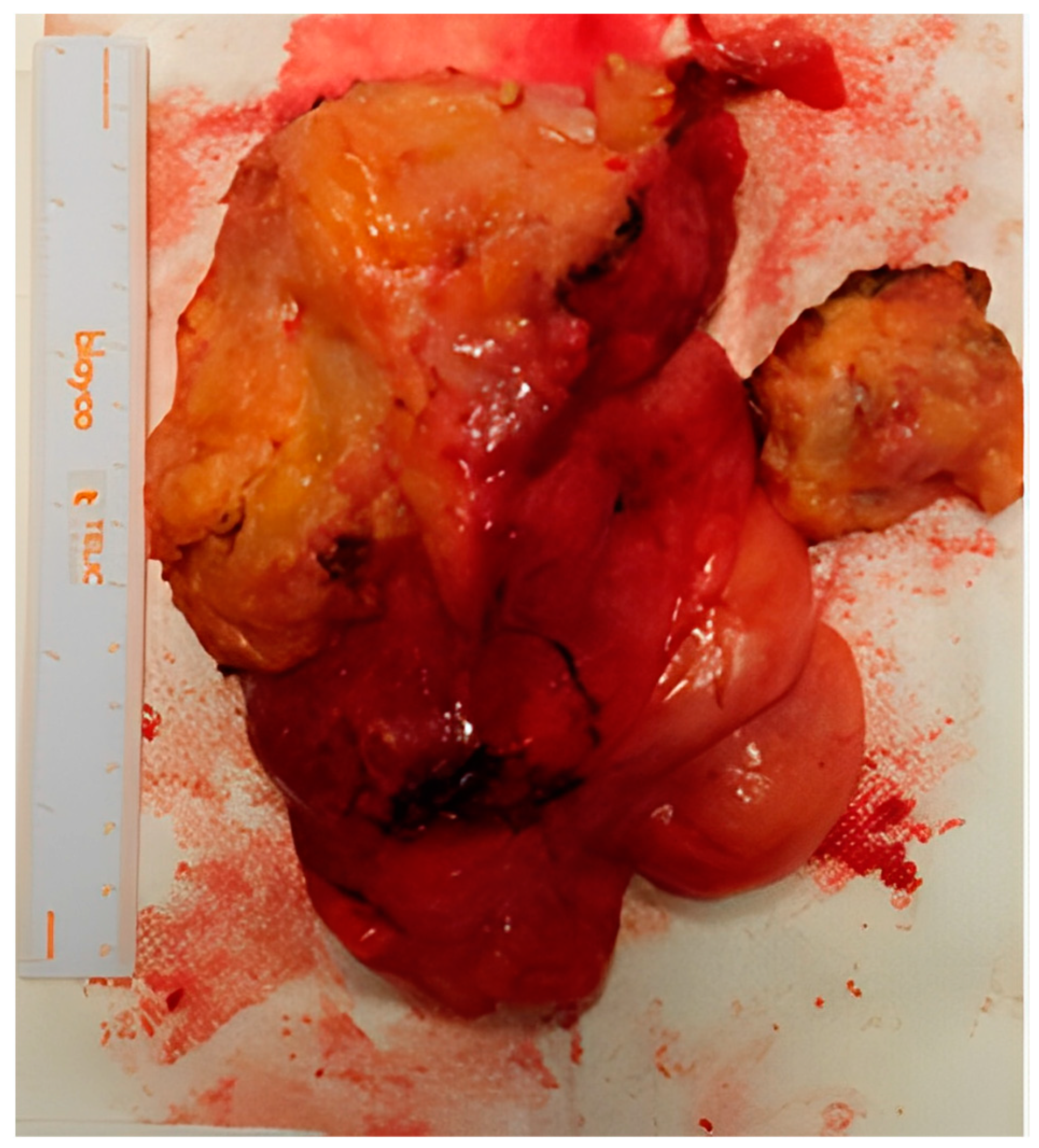 Medicina 59 01417 g003