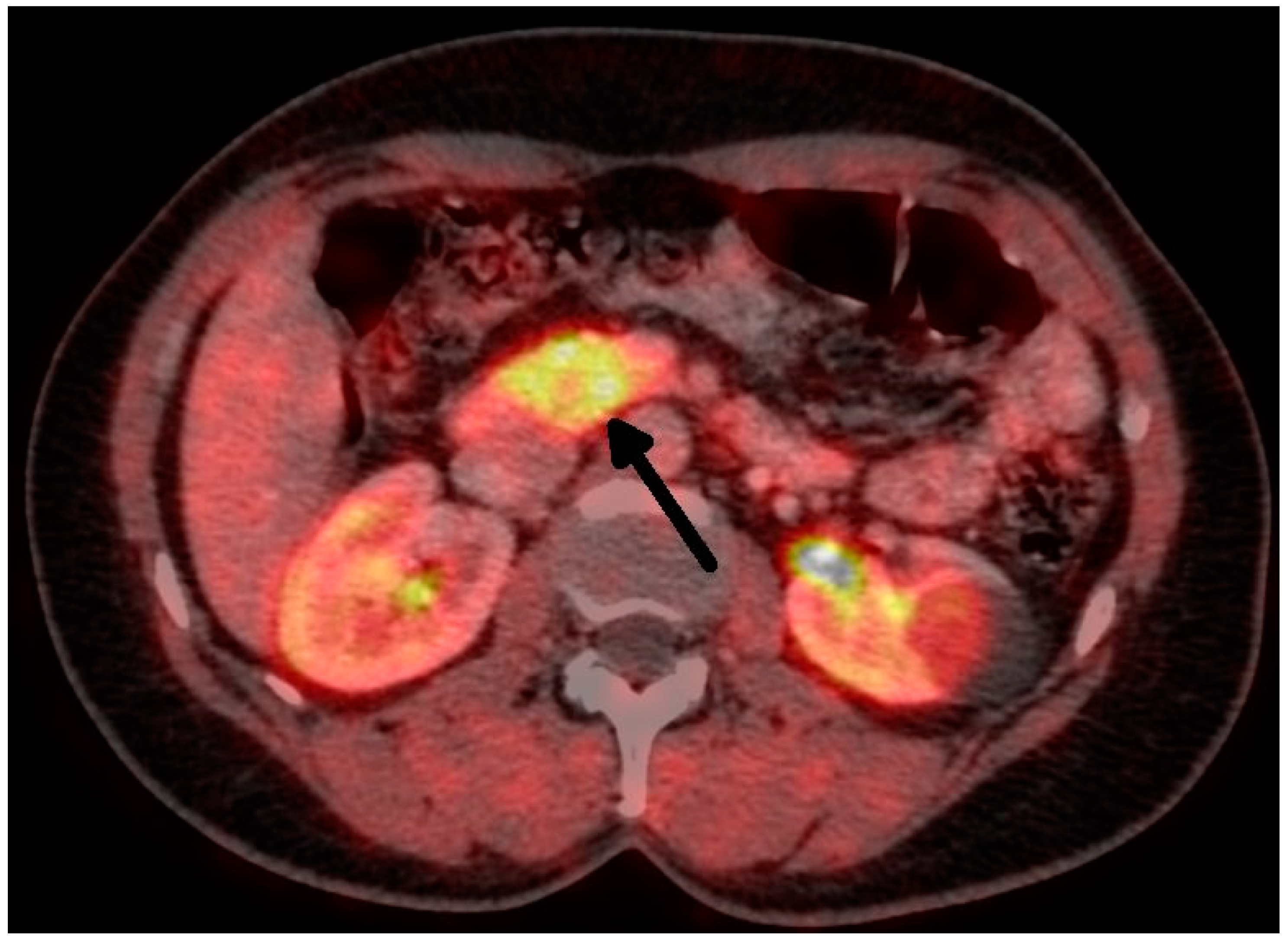 Medicina 59 01423 g002 Medicina 59 01423 g002