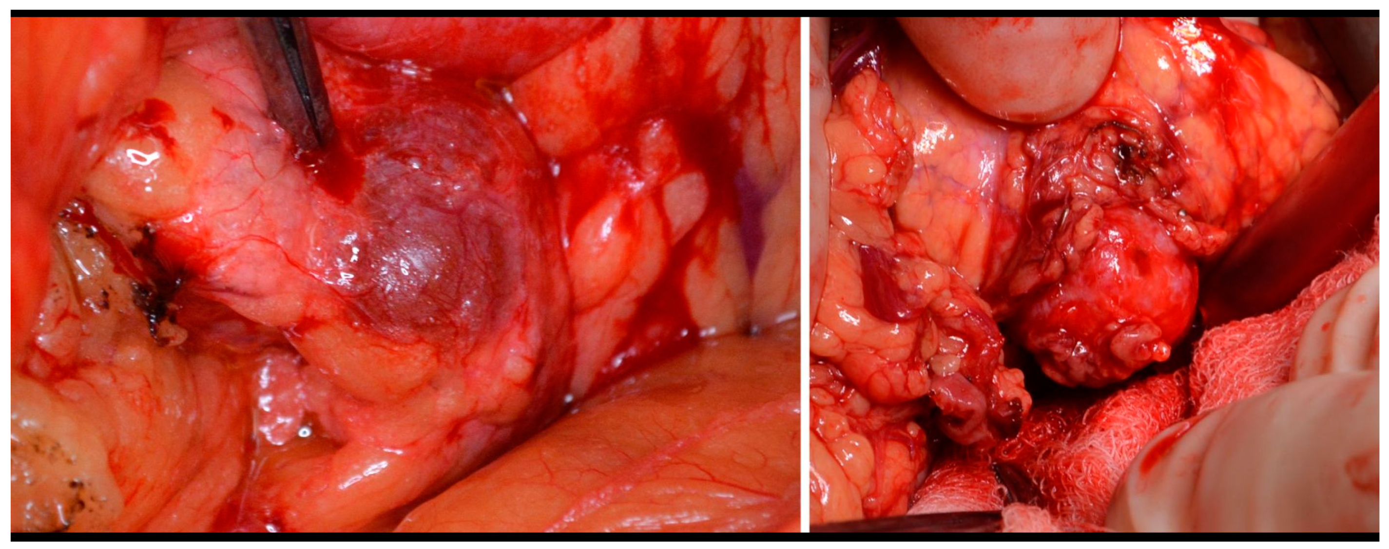 Medicina 59 01423 g003 Medicina 59 01423 g003