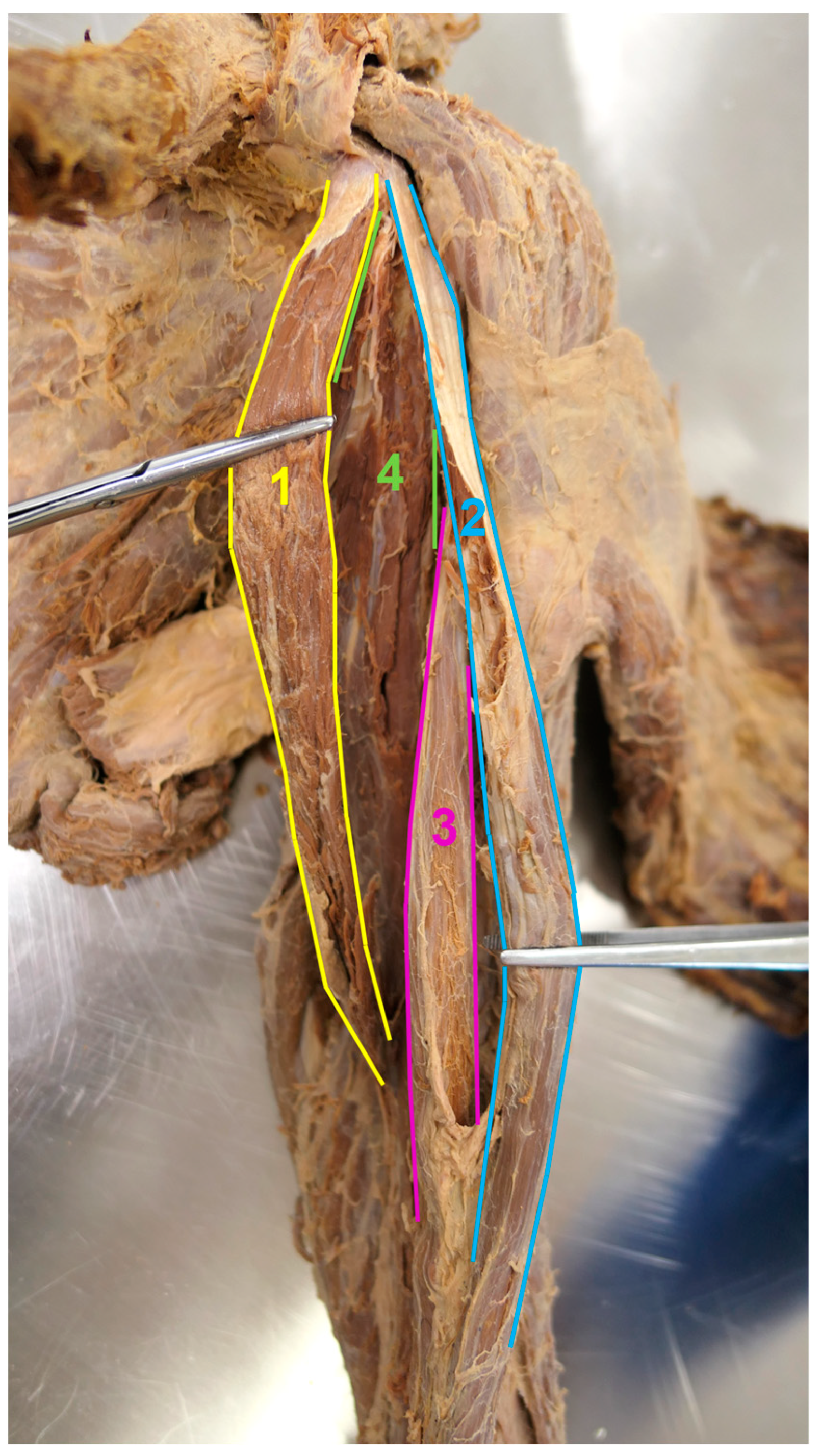 Medicina 59 01445 g004