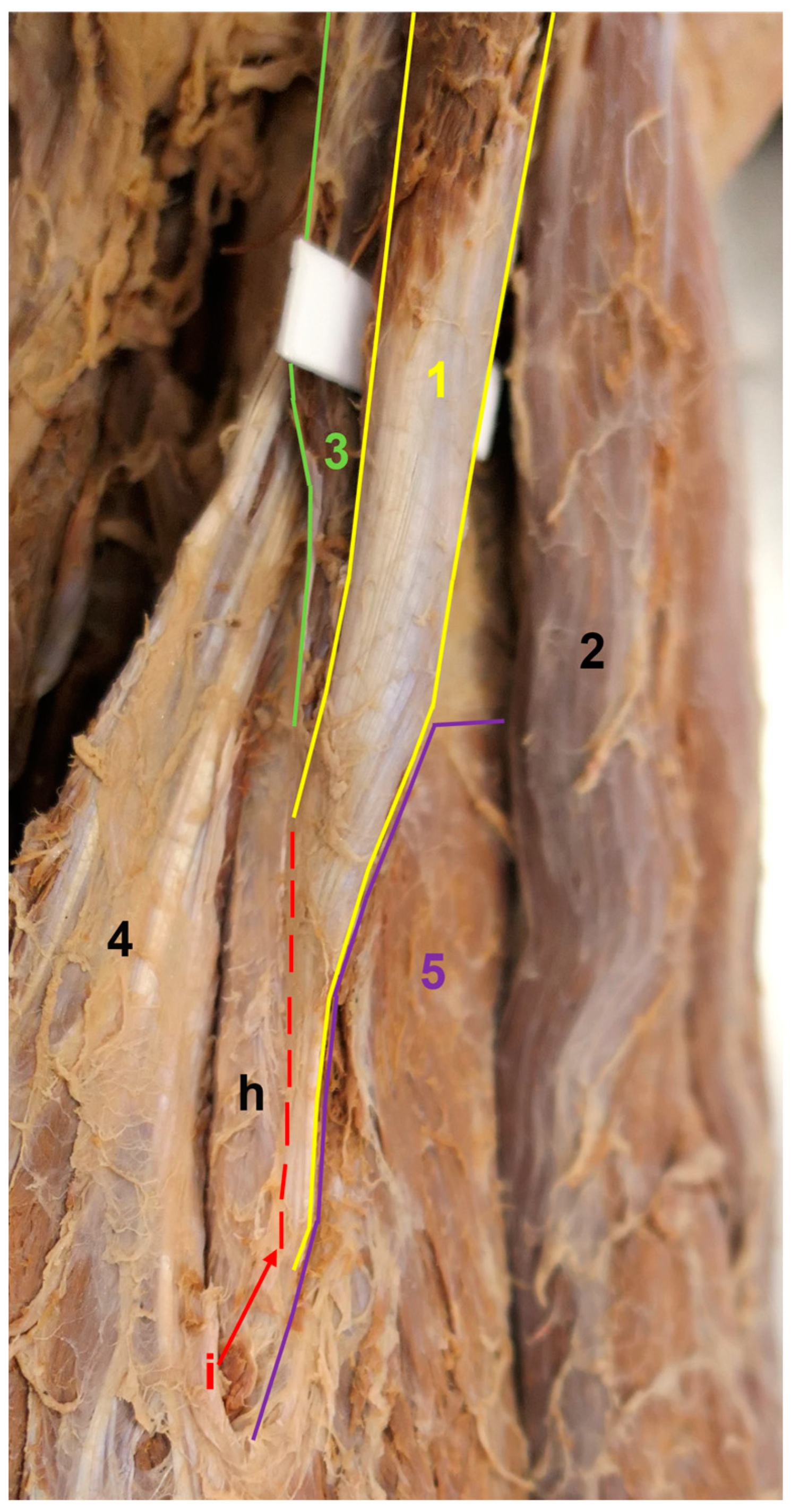 Medicina 59 01445 g006