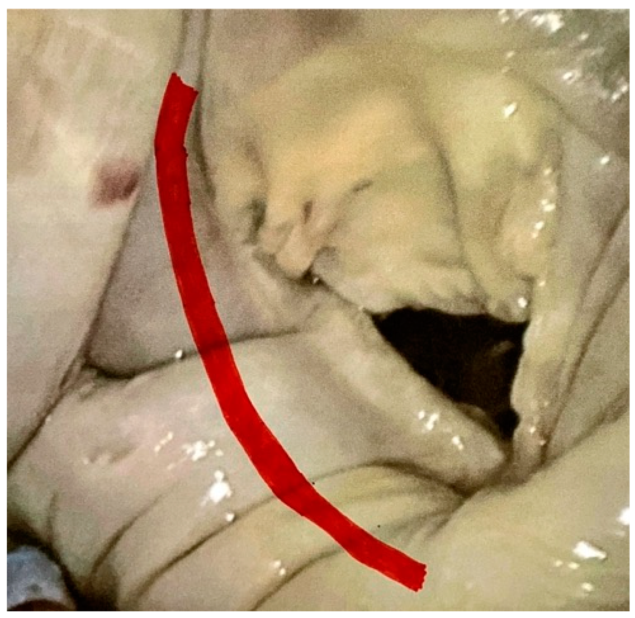 Medicina 59 01470 g002 Medicina 59 01470 g002