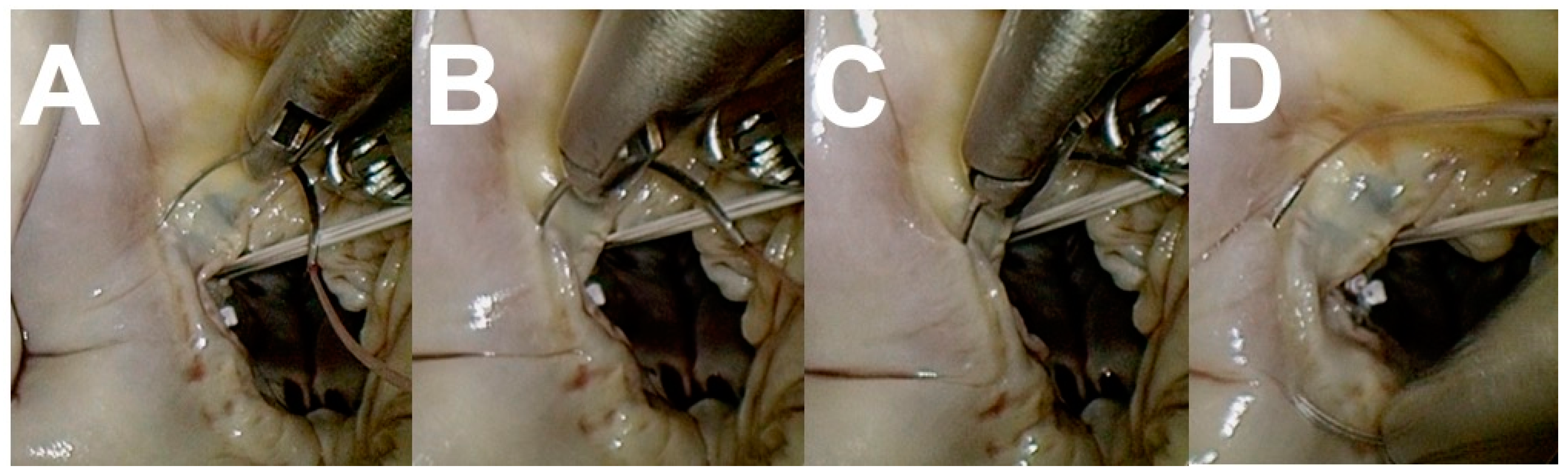 Medicina 59 01470 g004 Medicina 59 01470 g004