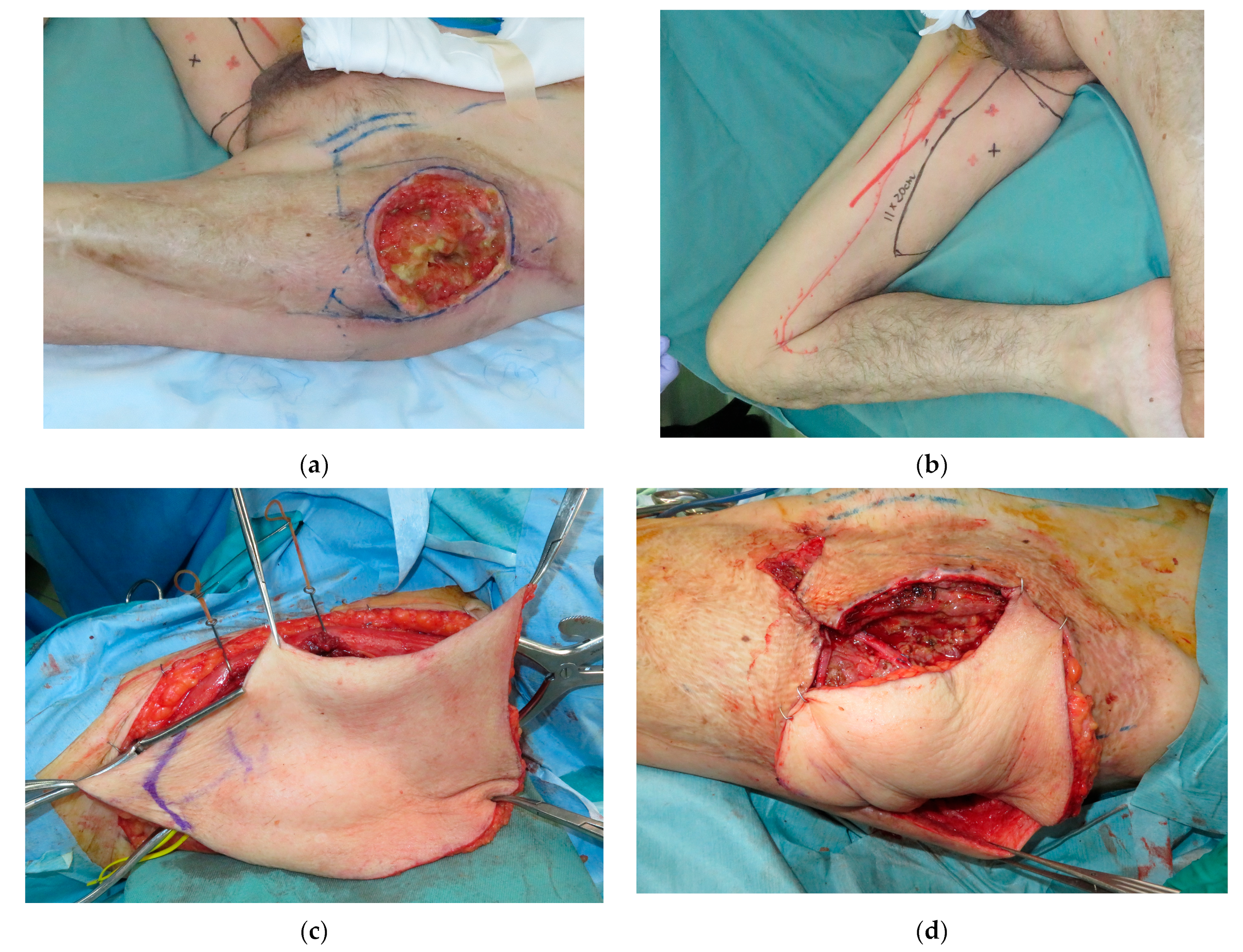 Medicina 59 01489 g001a