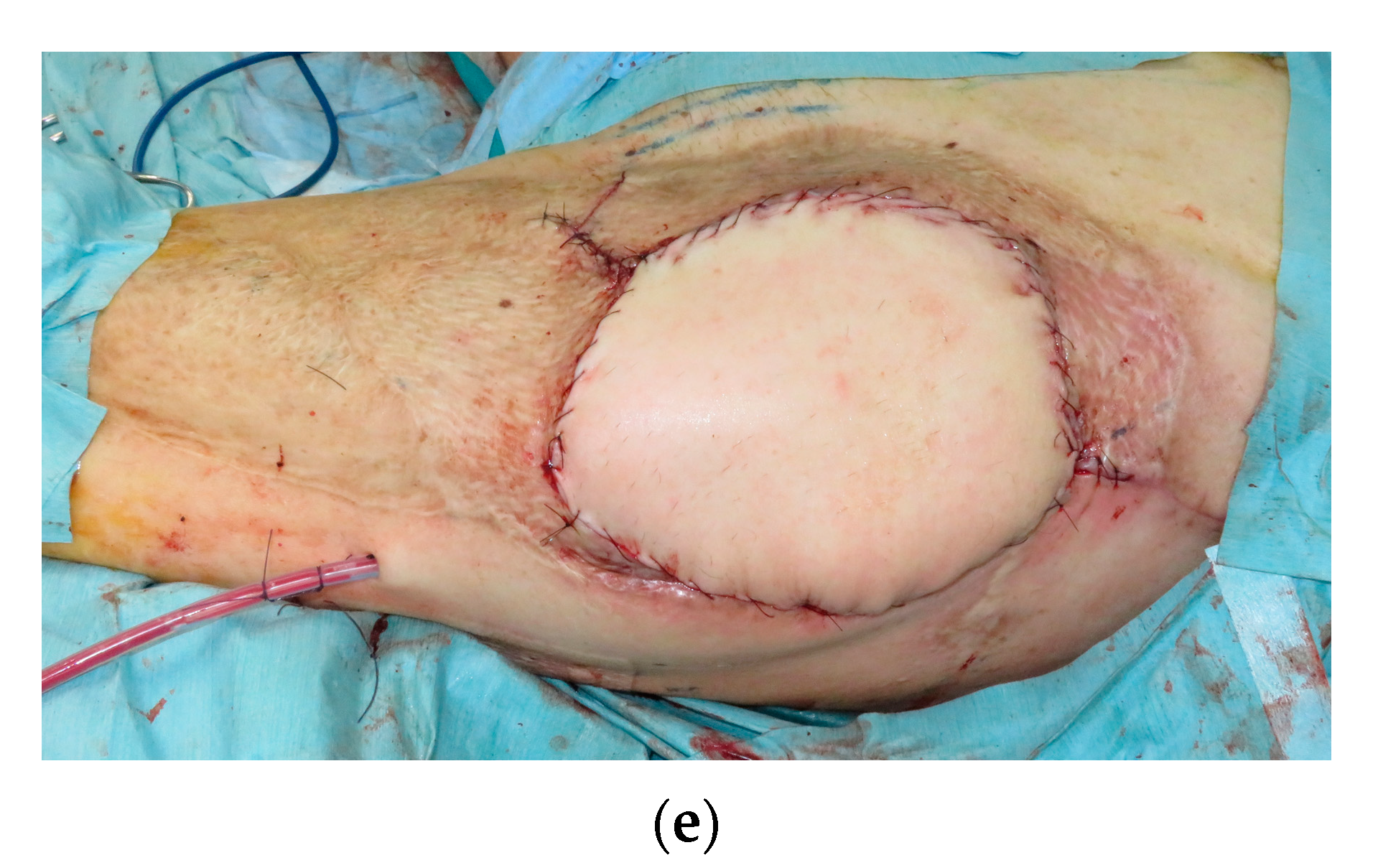 Medicina 59 01489 g001b