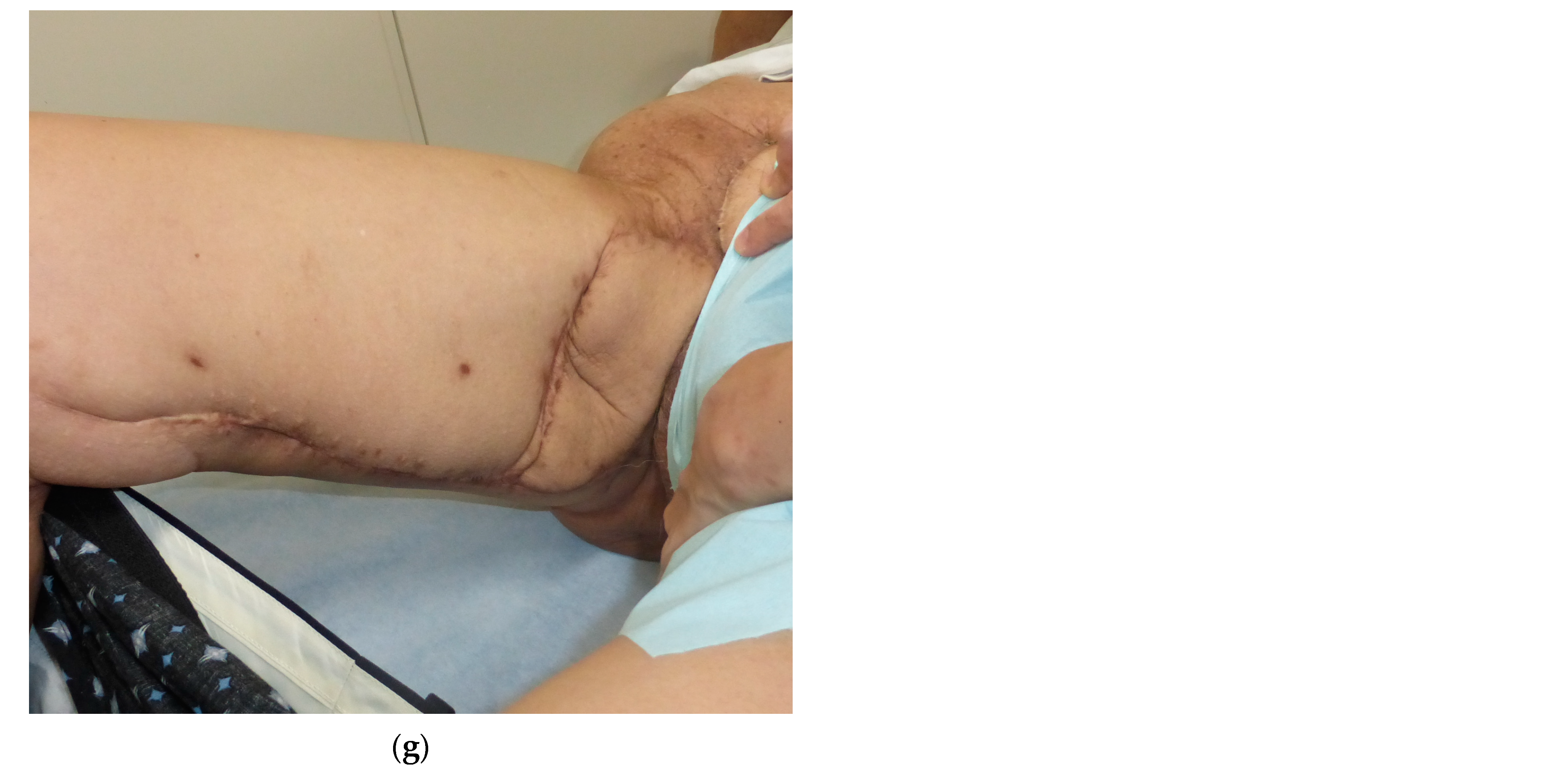 Medicina 59 01489 g004b