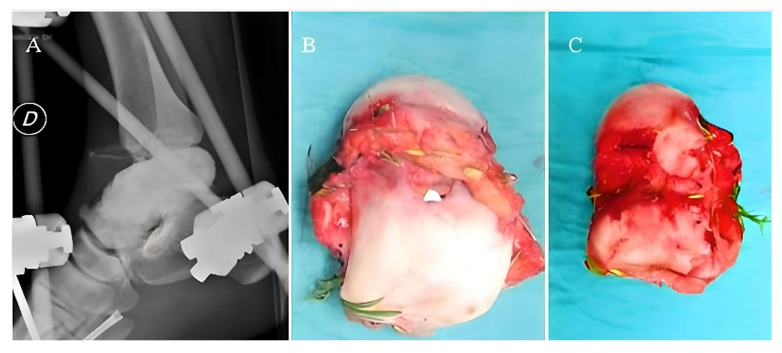 Medicina 59 01498 g007