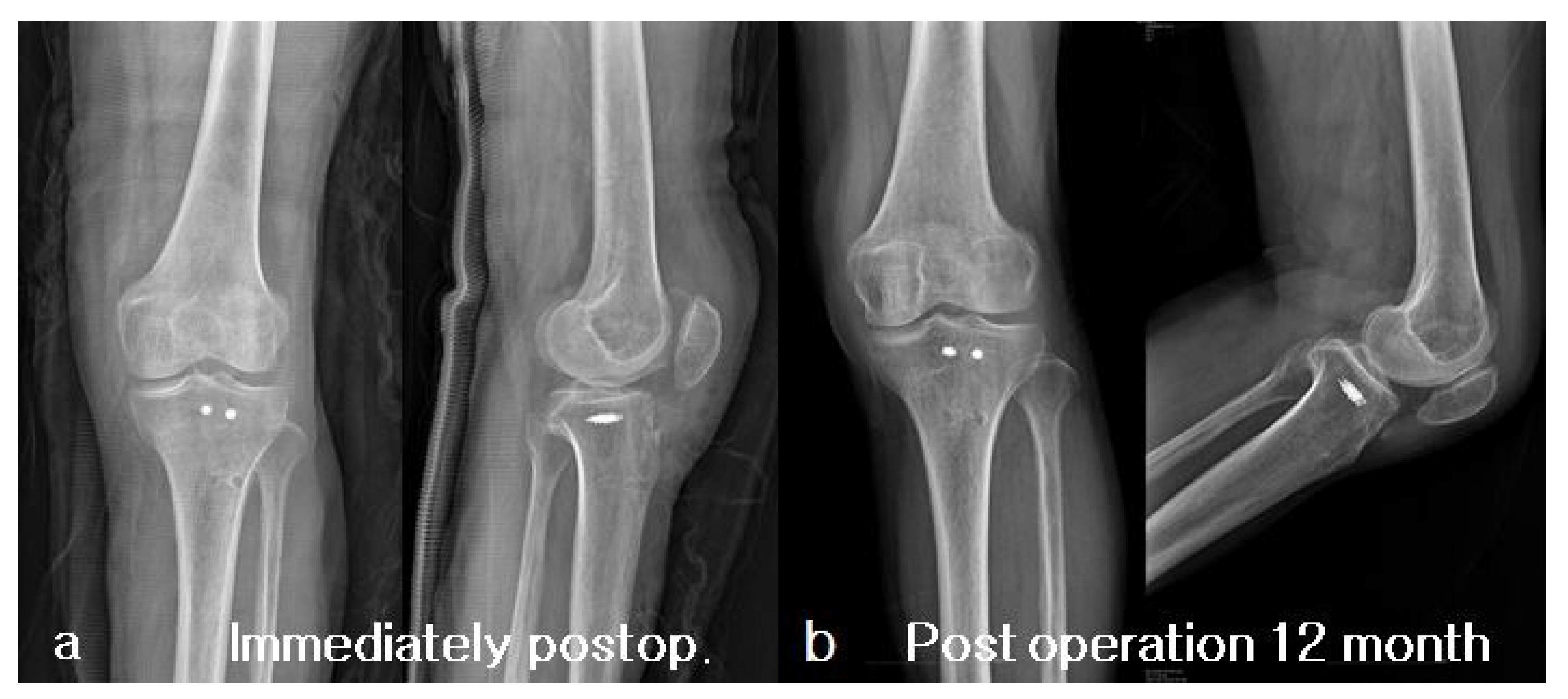 Medicina 59 01565 g005