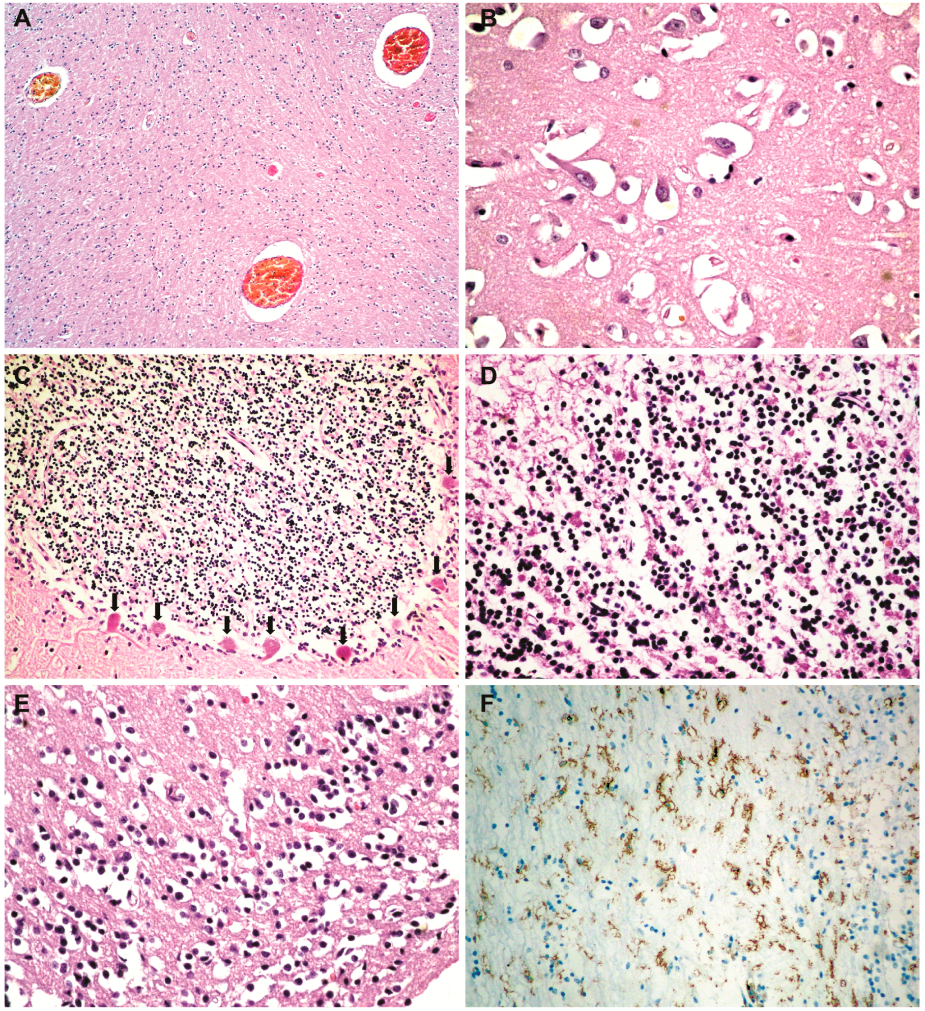 Medicina 59 01616 g002