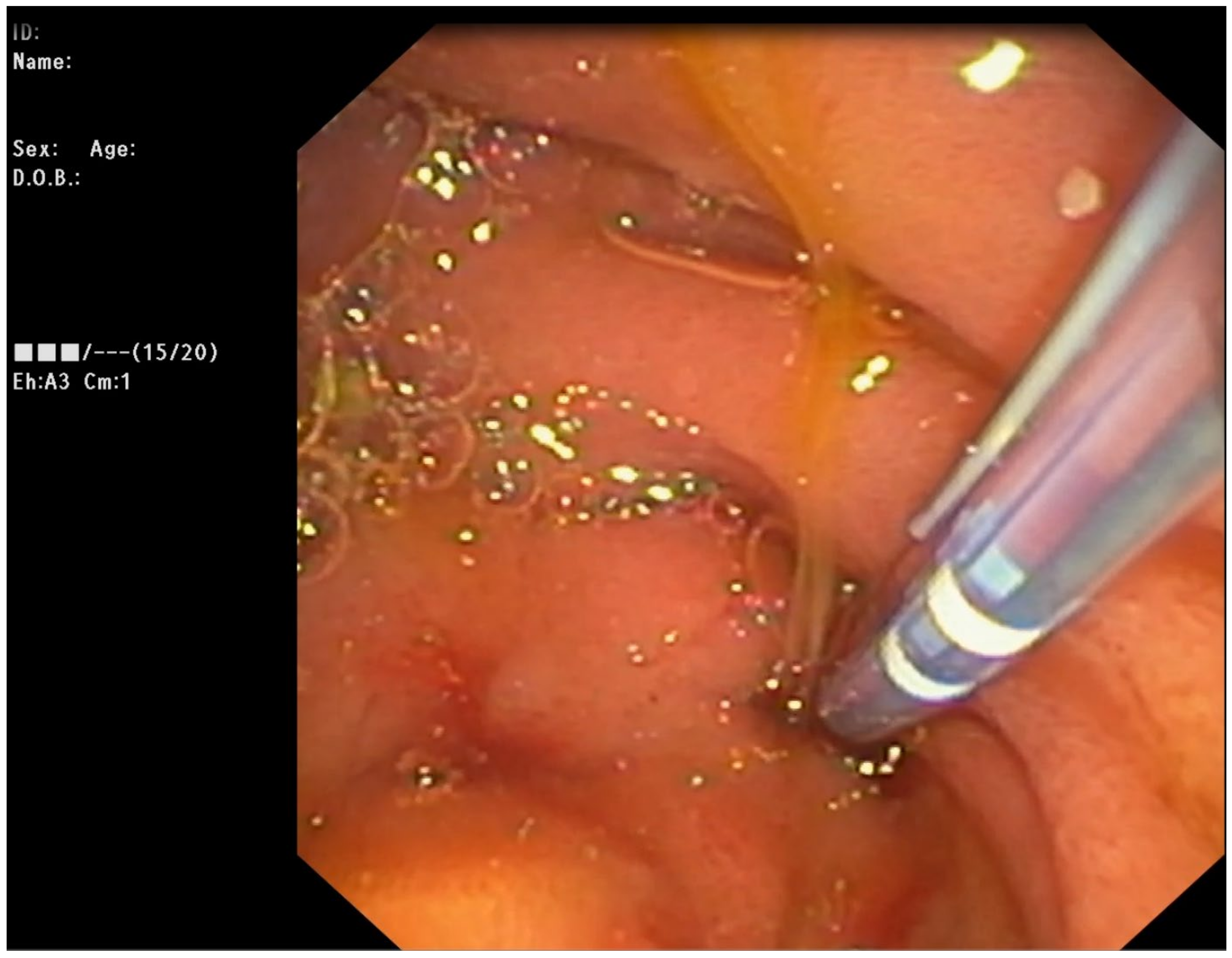 Medicina 59 01621 g001 Medicina 59 01621 g001