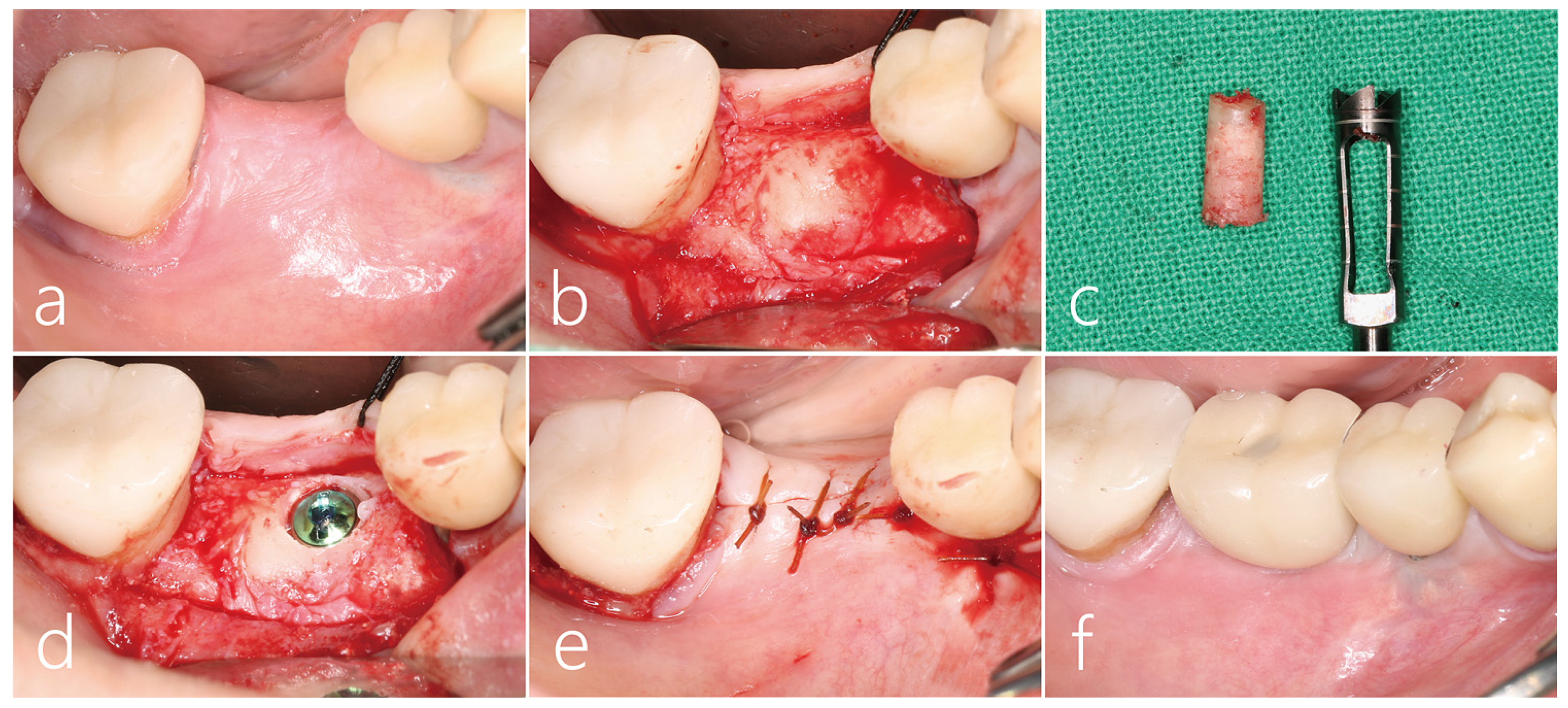 Medicina 59 01626 g003