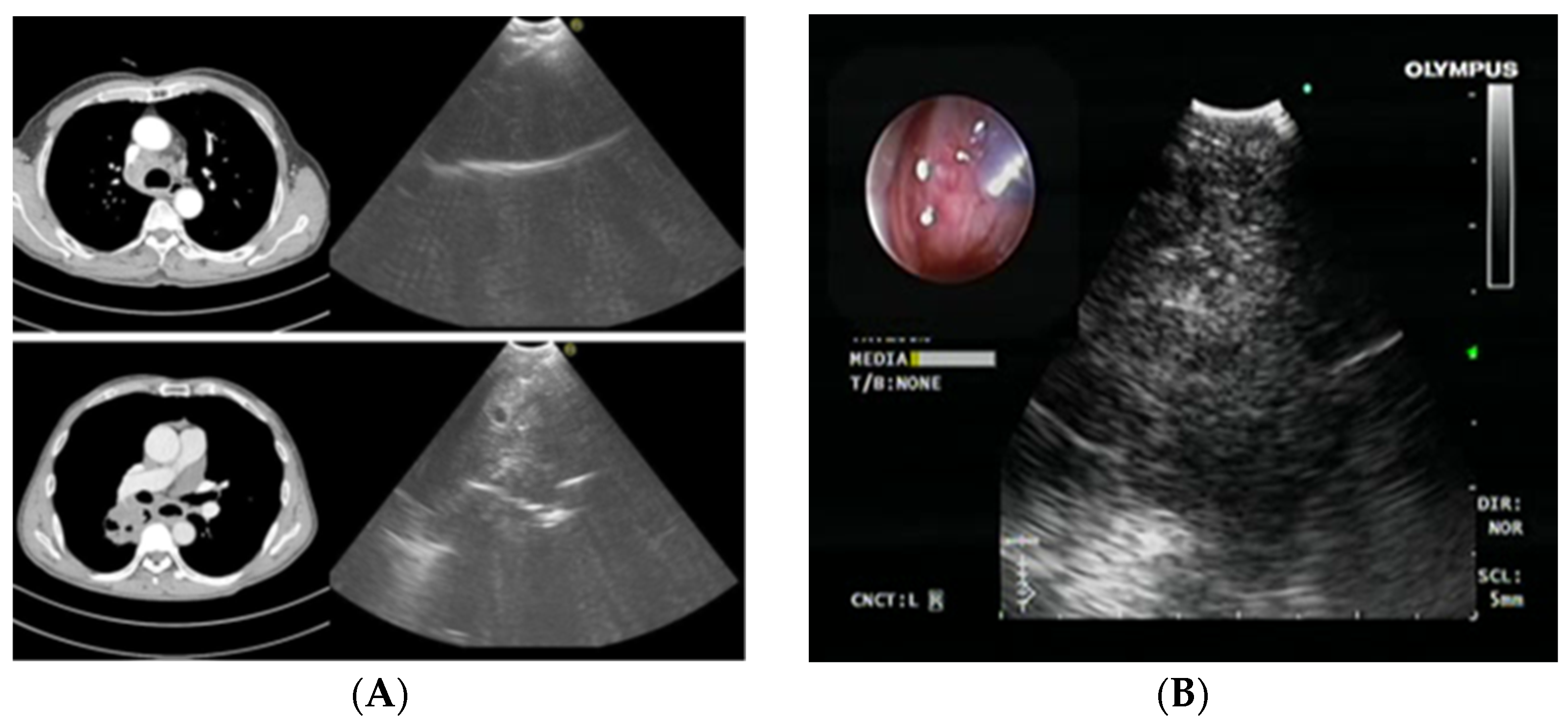 Medicina 59 01723 g004