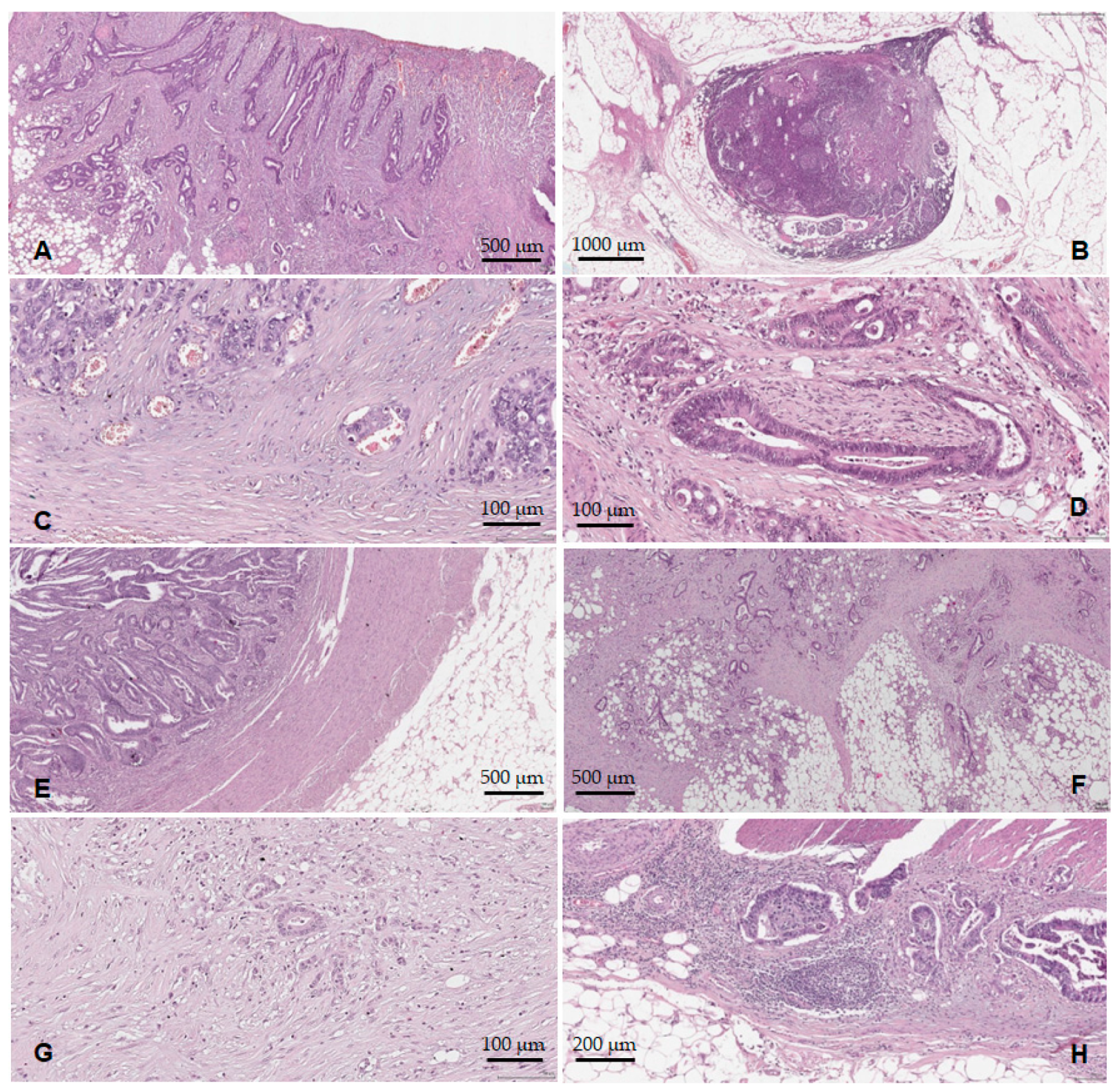 Medicina 59 01761 g004 Medicina 59 01761 g004
