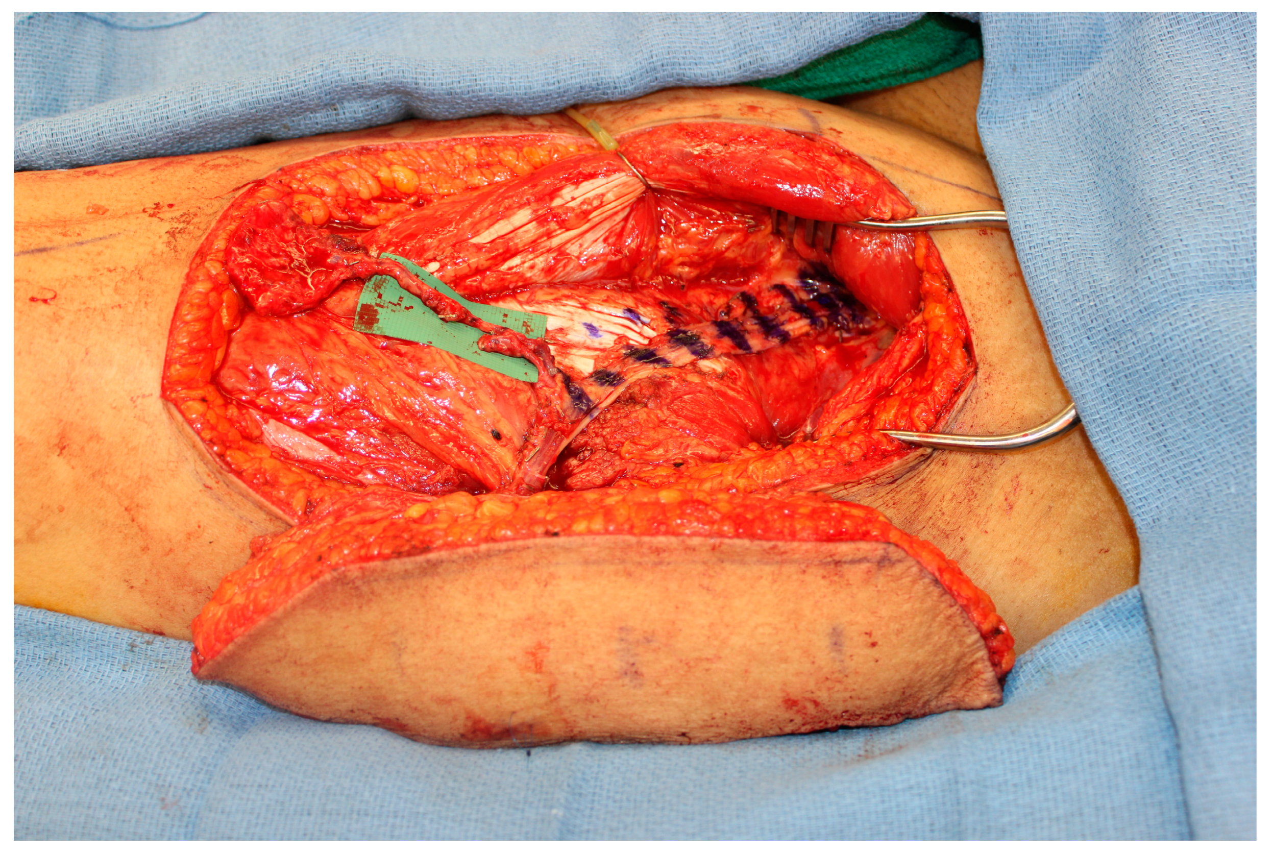 Medicina 59 01762 g004